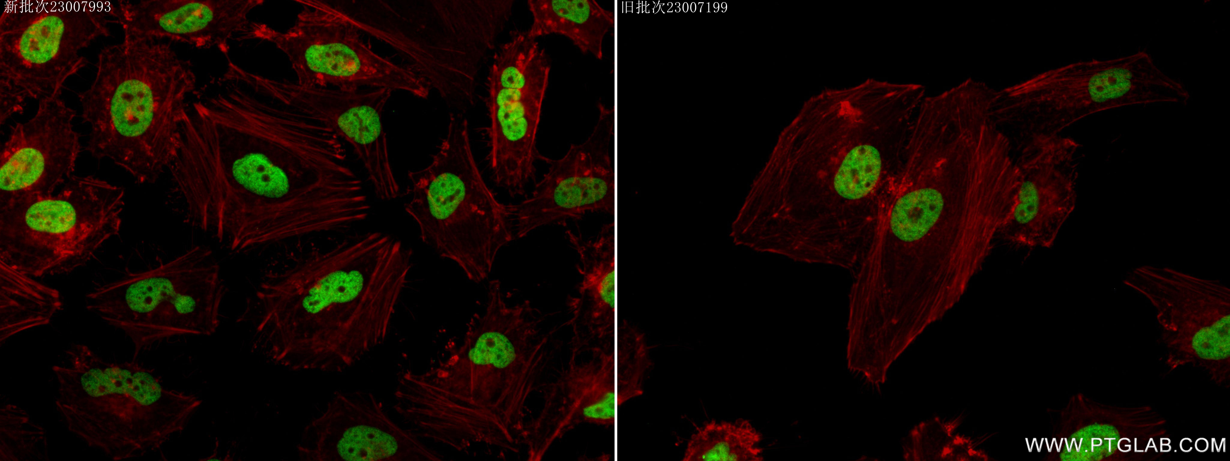 Immunofluorescence (IF) / fluorescent staining of HeLa cells using Acetyl-Histone H2A (Lys9) Recombinant antibody (83041-1-RR)