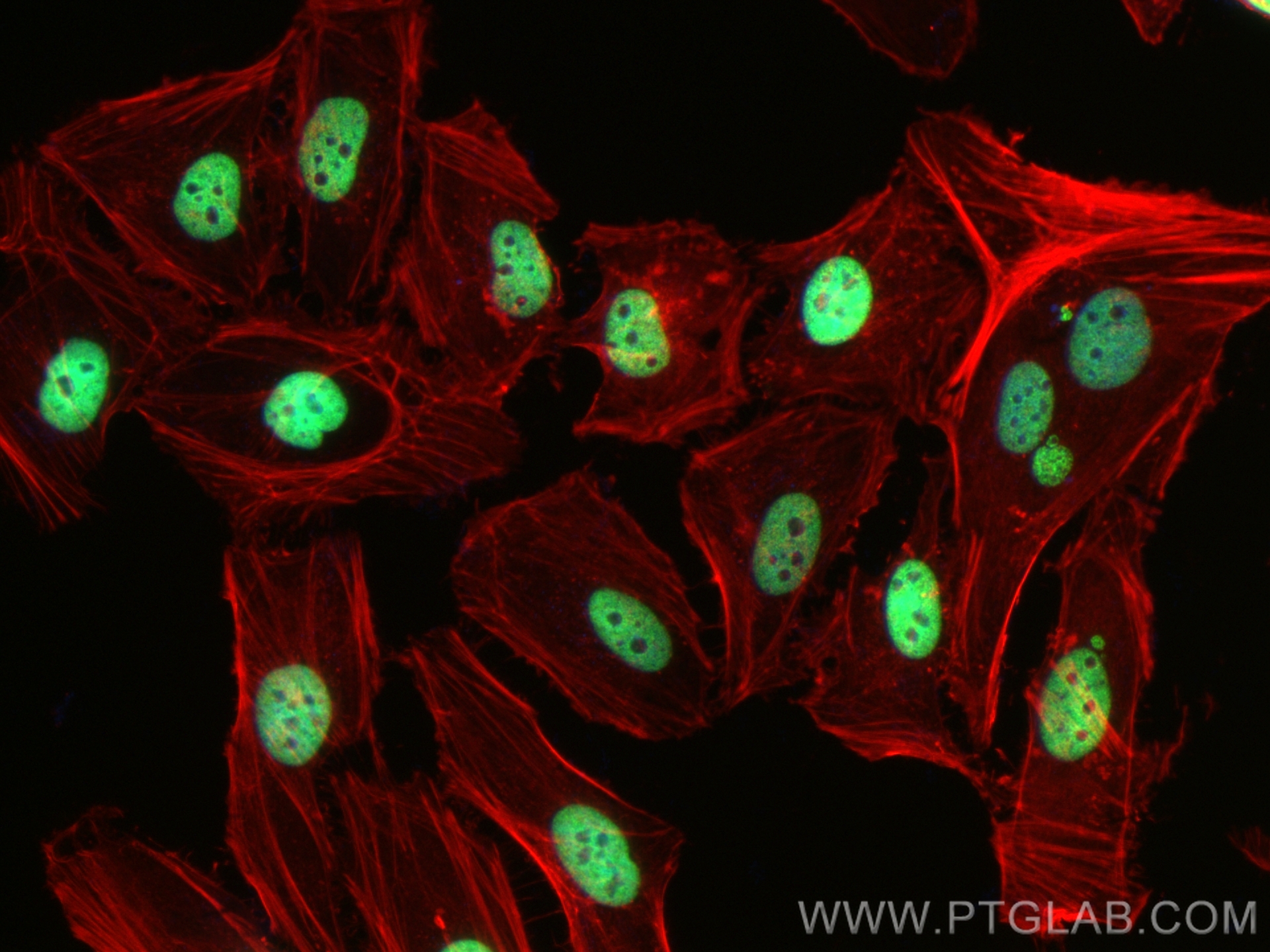 Immunofluorescence (IF) / fluorescent staining of HeLa cells using Acetyl-Histone H2A (Lys9) Recombinant antibody (83041-1-RR)