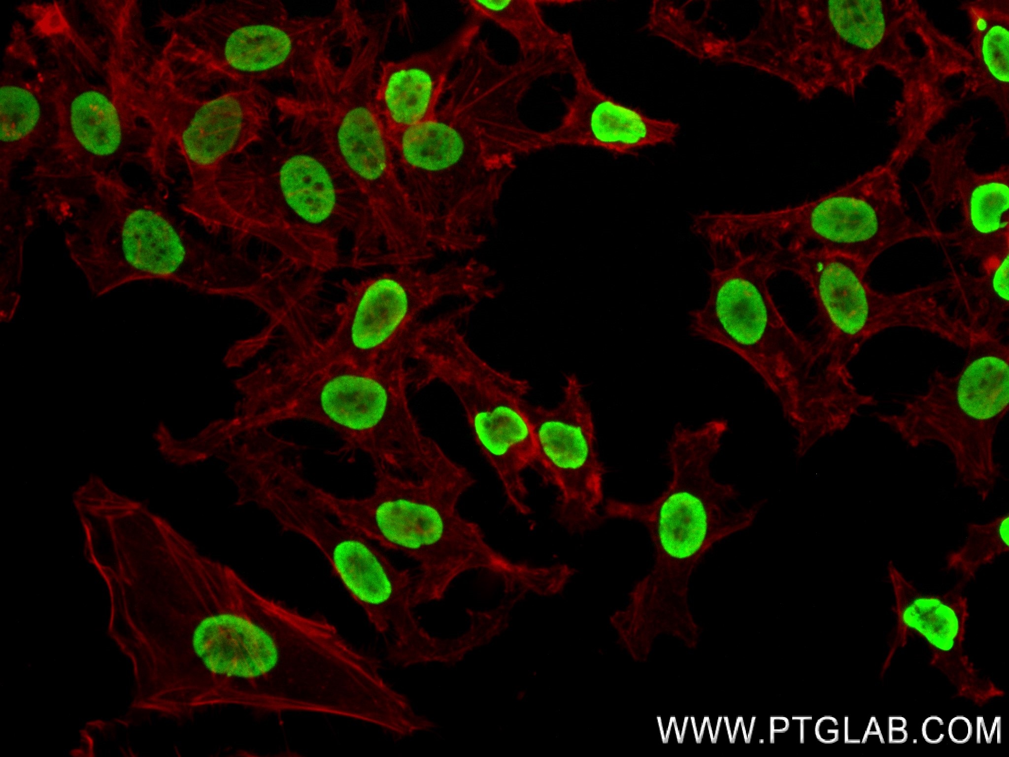 Immunofluorescence (IF) / fluorescent staining of HeLa cells using Acetyl-Histone H2A (Lys9) Recombinant antibody (83041-1-RR)