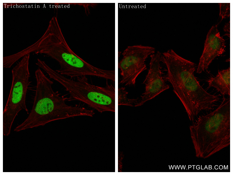 Acetyl-Histone H2B (Lys120)