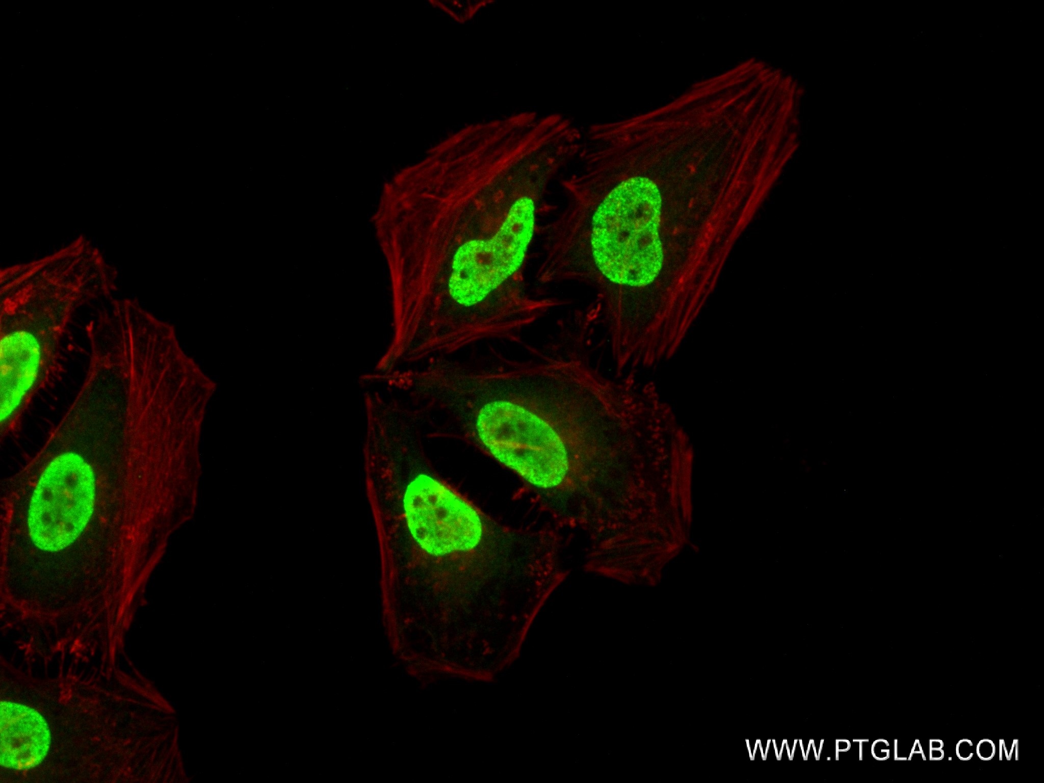 Acetyl-Histone H2B (Lys16)