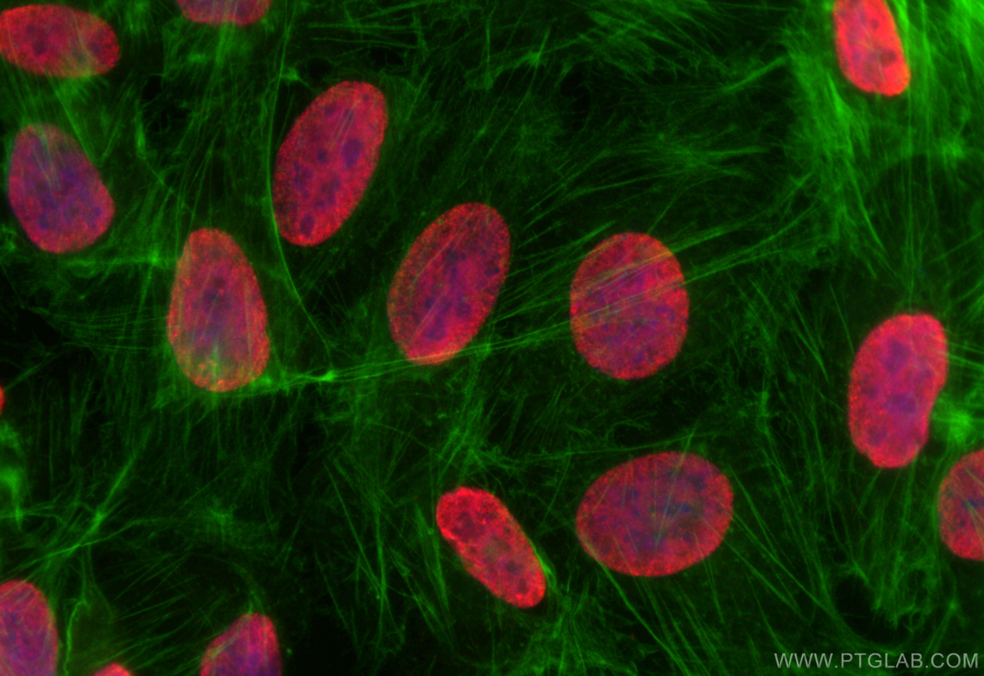 Immunofluorescence (IF) / fluorescent staining of U2OS cells using Acetyl-Histone H2B (Lys16) Recombinant antibody (84446-1-RR)