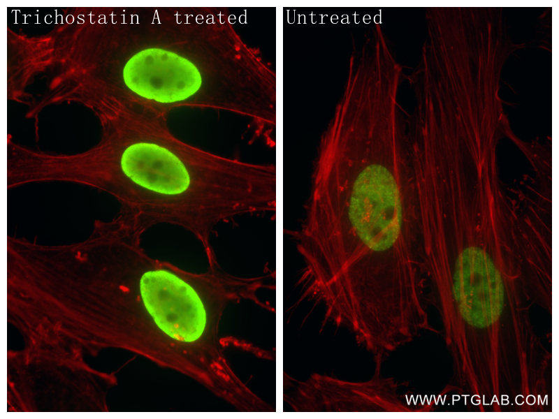 Immunofluorescence (IF) / fluorescent staining of HeLa cells using Acetyl-Histone H2B (Lys16) Recombinant antibody (84446-1-RR)