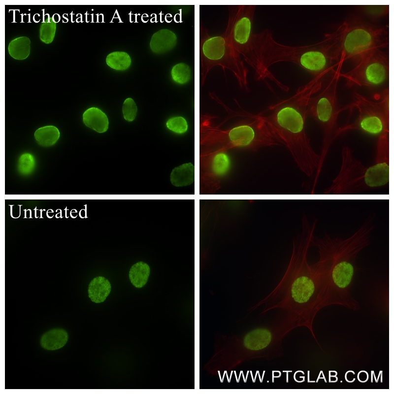 Immunofluorescence (IF) / fluorescent staining of NIH/3T3 cells using Acetyl-Histone H2B (Lys16) Recombinant antibody (84446-2-RR)