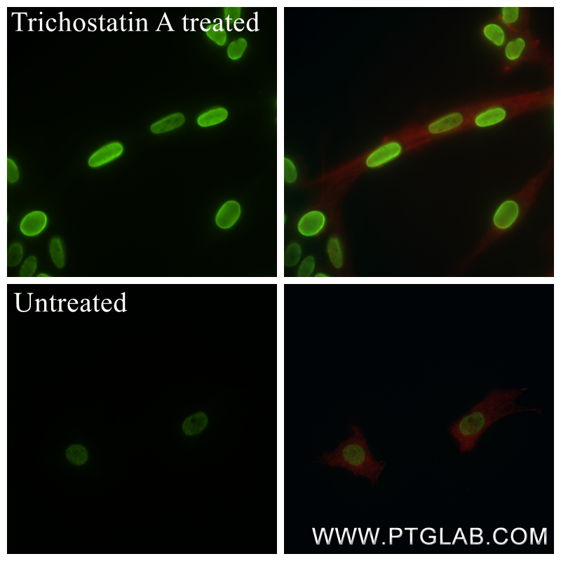 Immunofluorescence (IF) / fluorescent staining of C6 cells using Acetyl-Histone H2B (Lys16) Recombinant antibody (84446-2-RR)