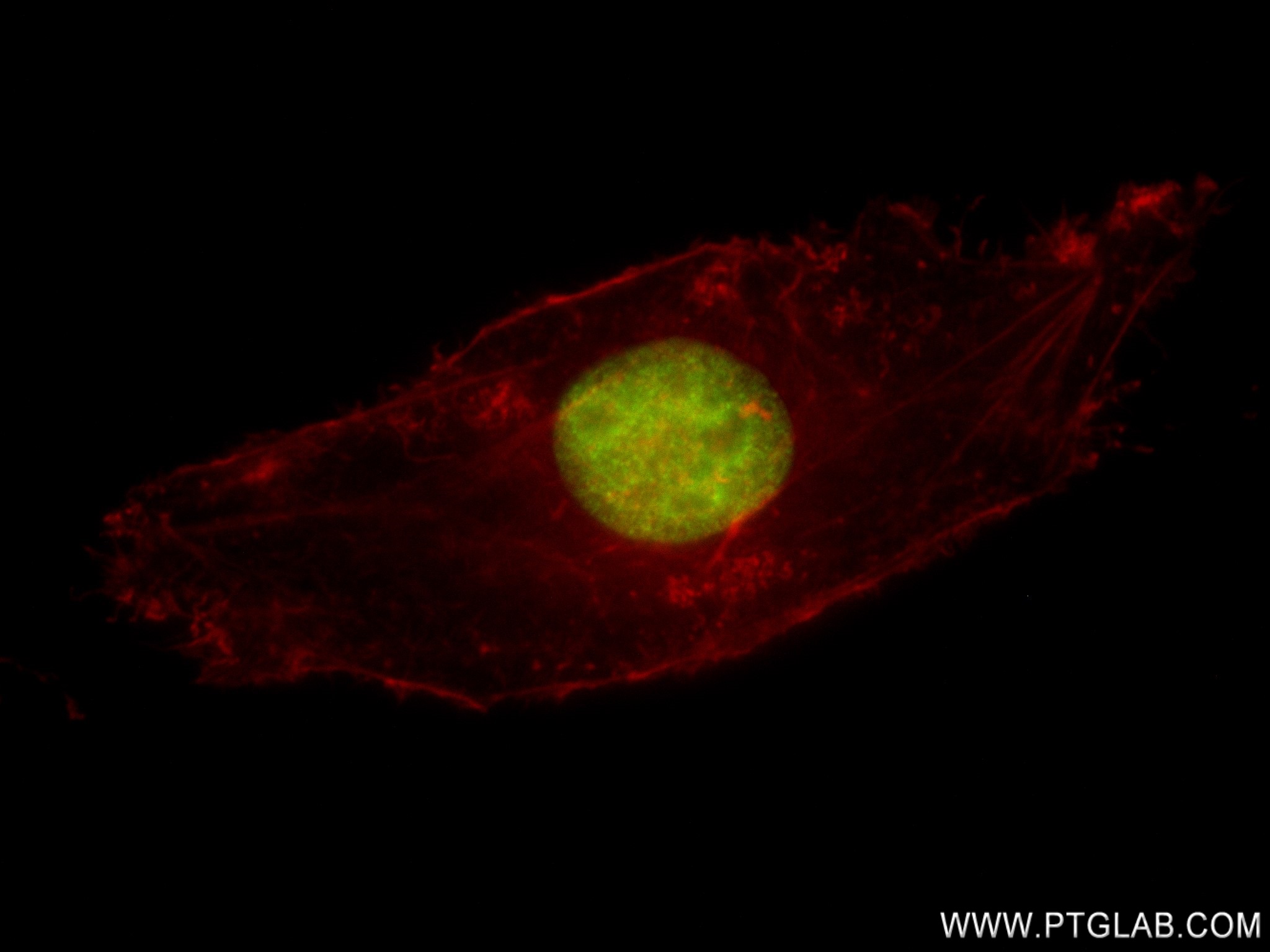 Immunofluorescence (IF) / fluorescent staining of HeLa cells using Acetyl-Histone H2B (Lys5) Recombinant antibody (83171-4-RR)