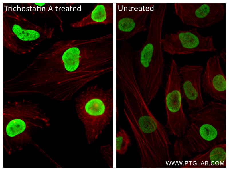 Immunofluorescence (IF) / fluorescent staining of HeLa cells using Acetyl-Histone H2B (Lys5) Recombinant antibody (83171-4-RR)