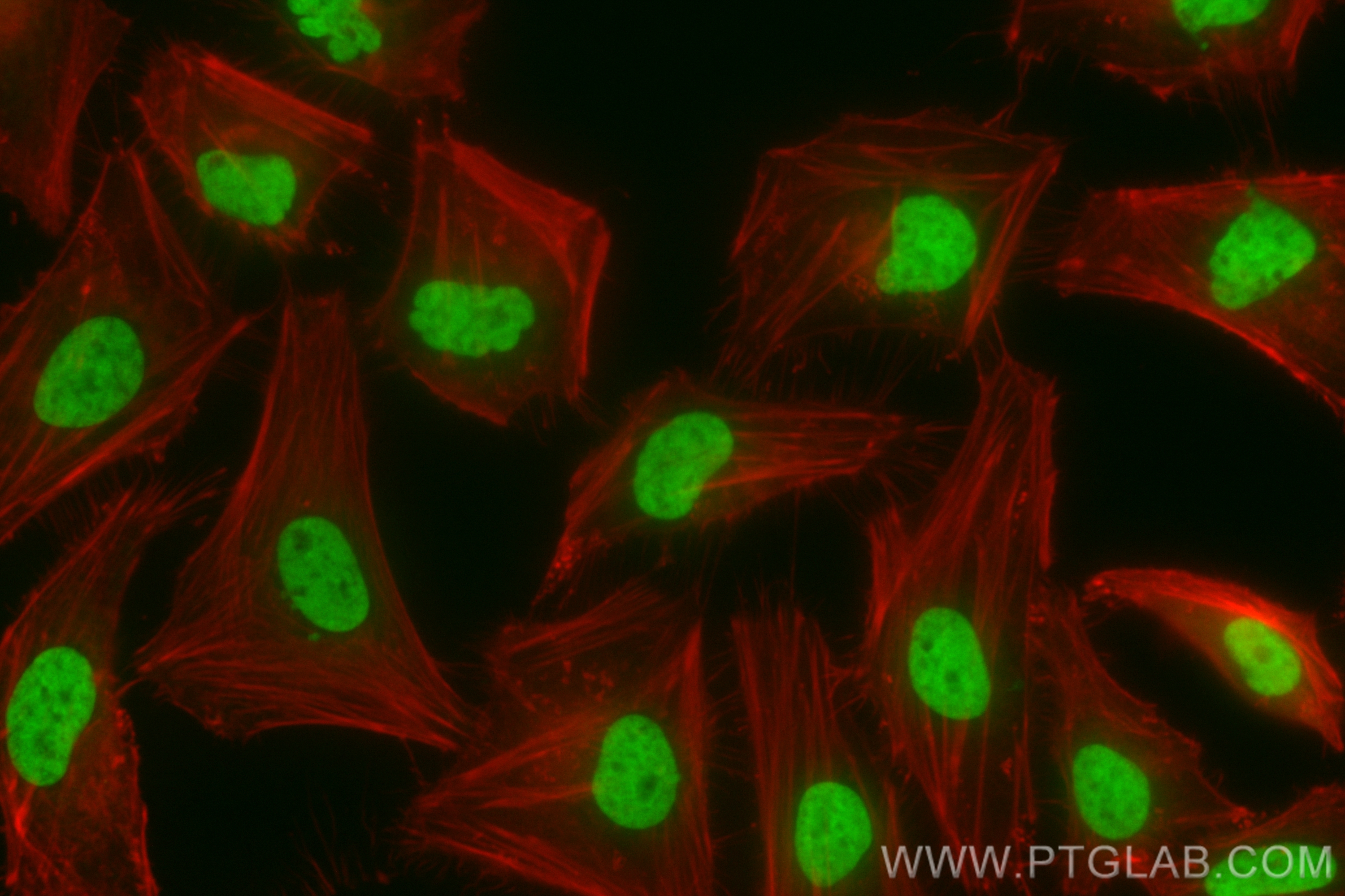 Immunofluorescence (IF) / fluorescent staining of Hela cells using CoraLite® Plus 488-conjugated Acetyl-Histone H2B ( (CL488-83171-4)