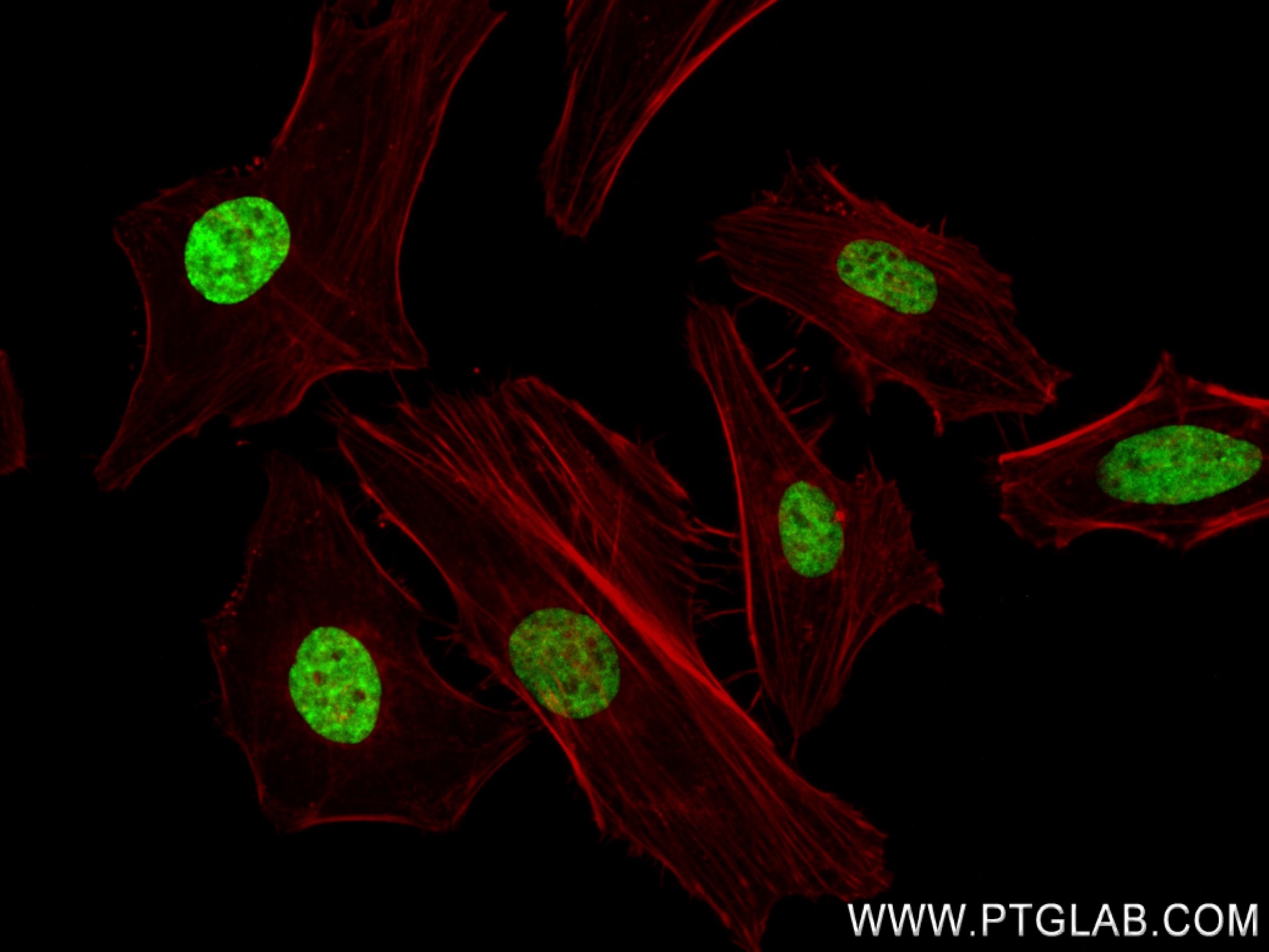 Immunofluorescence (IF) / fluorescent staining of HeLa cells using Acetyl-Histone H3 (Lys23) Recombinant antibody (82838-2-RR)