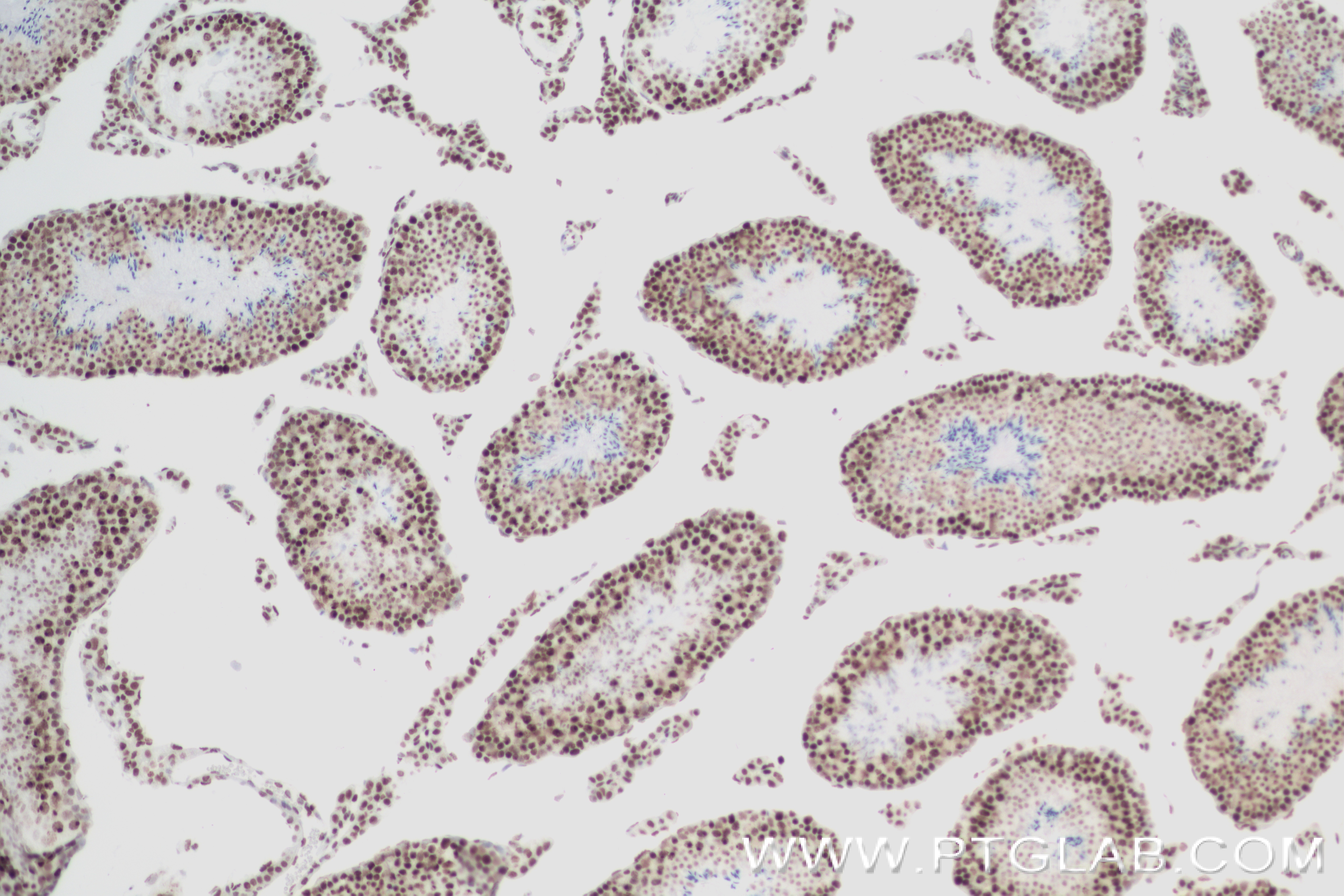 Immunohistochemistry (IHC) staining of mouse testis tissue using Acetyl-Histone H3 (Lys23) Recombinant antibody (82838-2-RR)