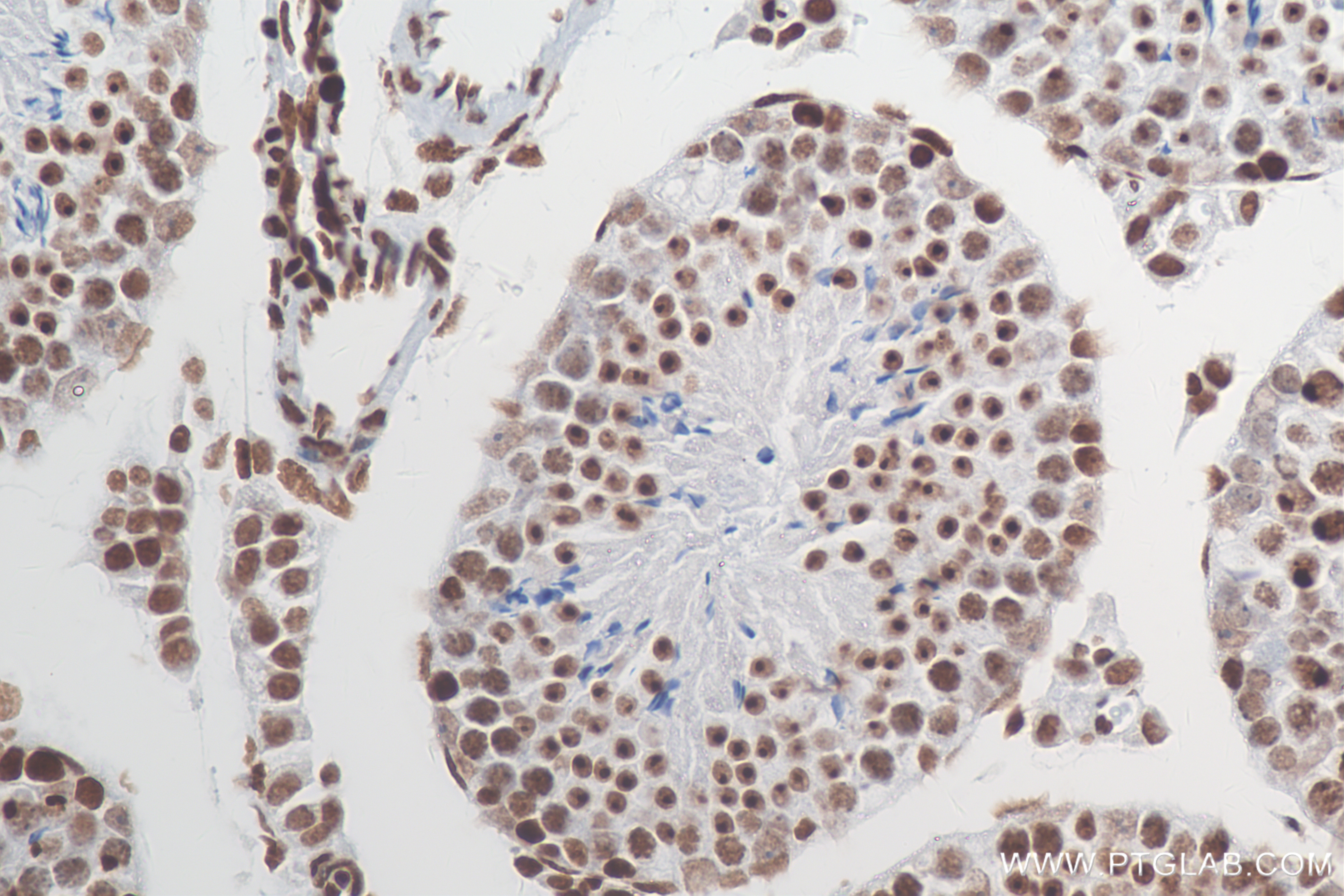 Immunohistochemistry (IHC) staining of mouse testis tissue using Acetyl-Histone H3 (Lys23) Recombinant antibody (82838-2-RR)