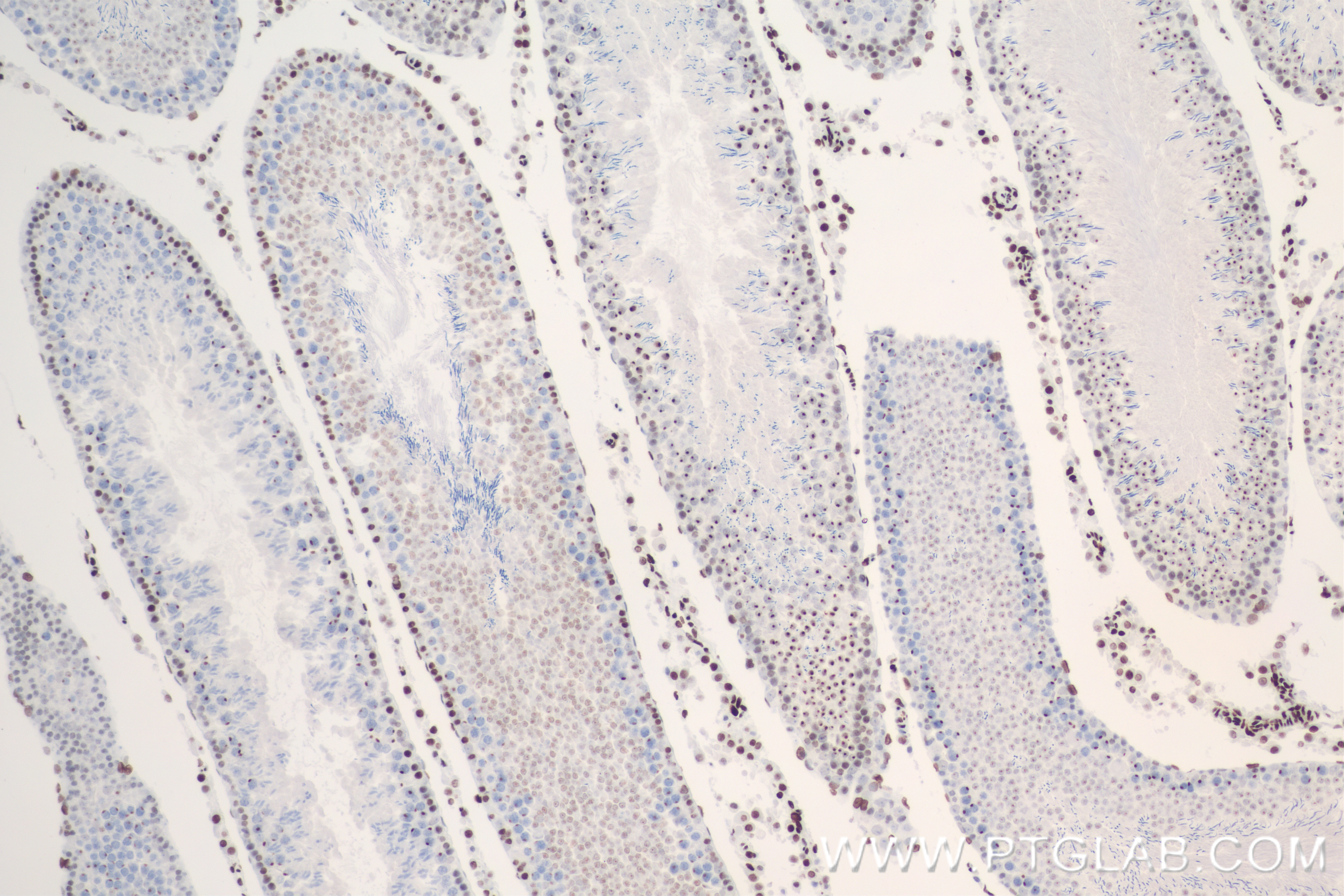 Immunohistochemistry (IHC) staining of rat testis tissue using Acetyl-Histone H3 (Lys23) Recombinant antibody (82838-2-RR)