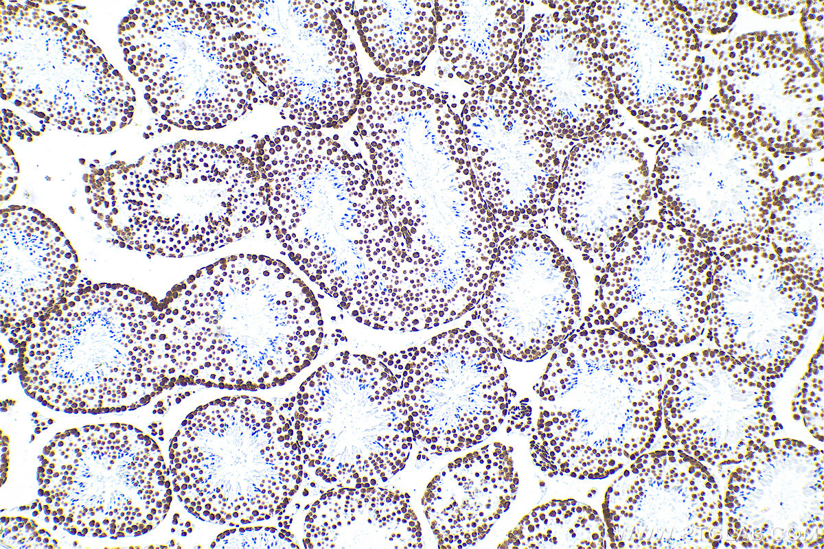 Immunohistochemistry (IHC) staining of mouse testis tissue using Acetyl-Histone H3 (Lys27) Recombinant antibody (82902-1-RR)