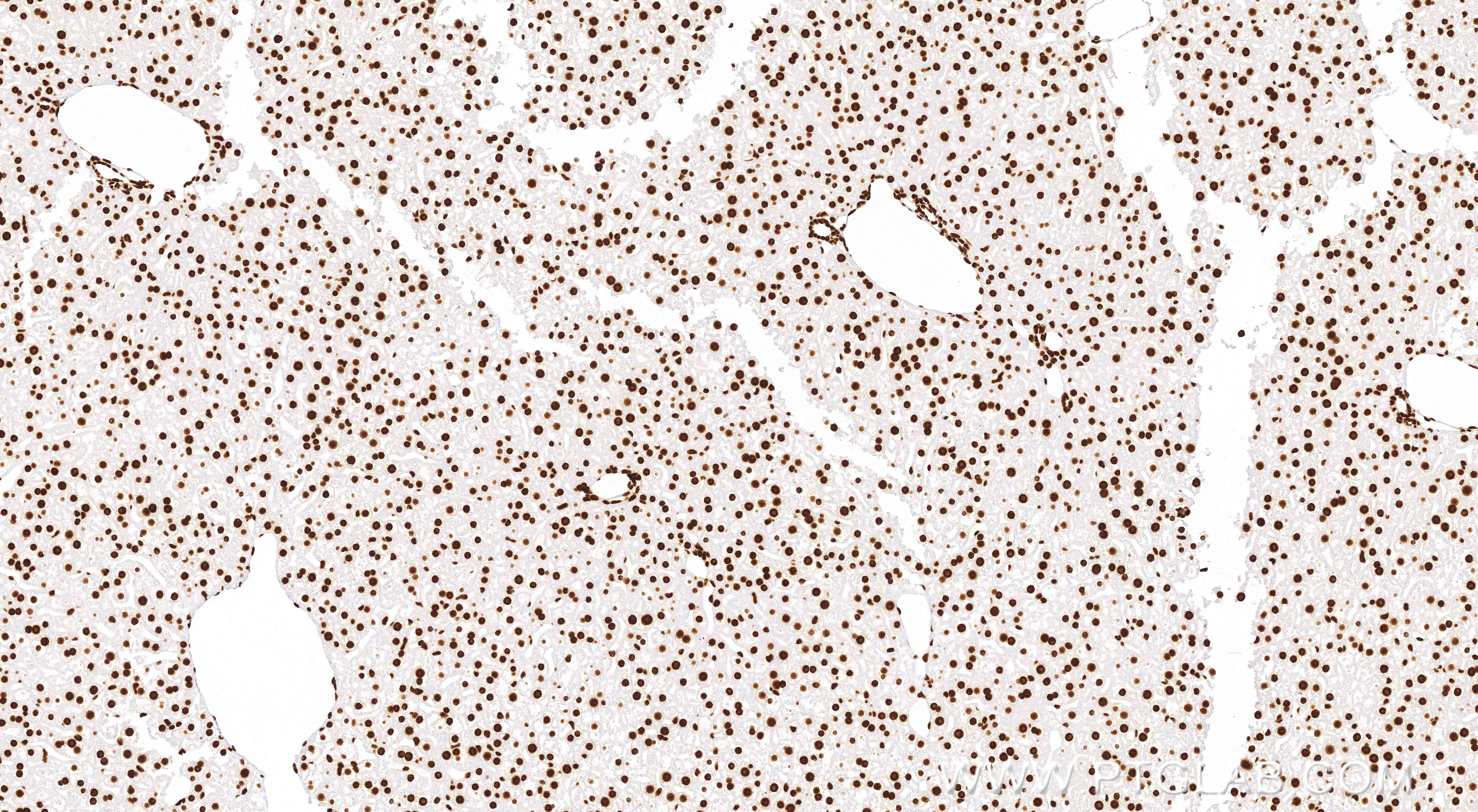 Immunohistochemistry (IHC) staining of mouse liver tissue using Acetyl-Histone H3 (Lys27) Recombinant monoclonal a (82902-1-RR)