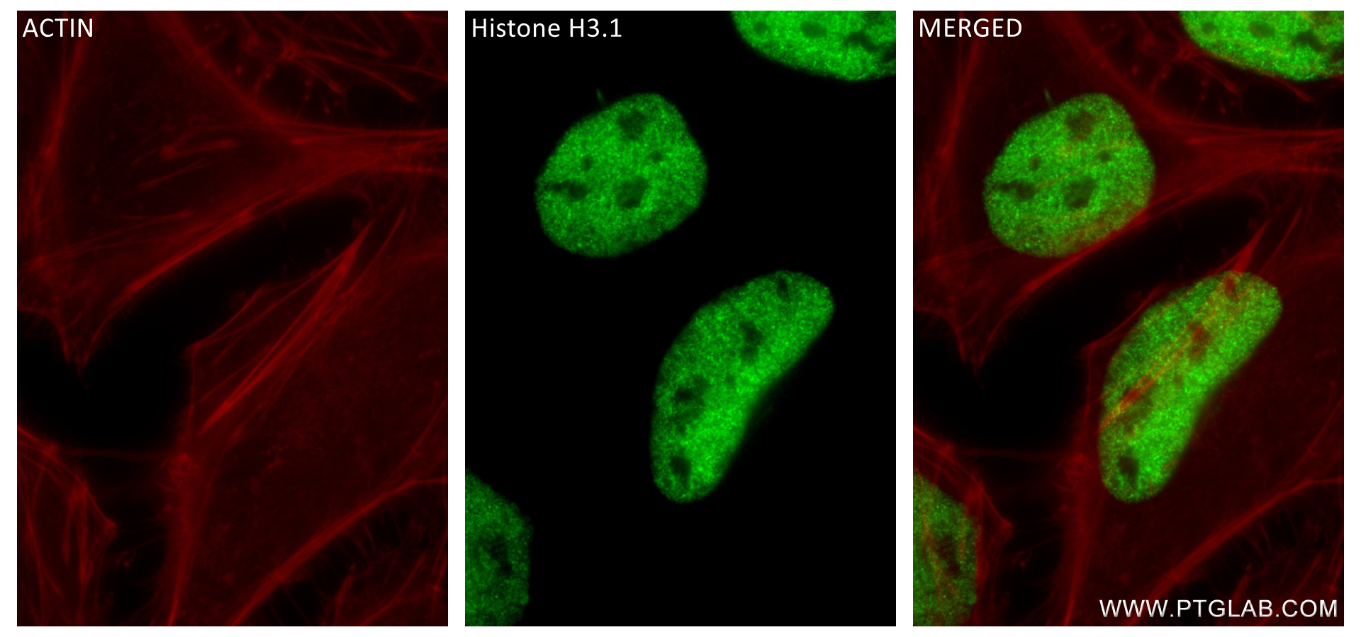 Immunofluorescence (IF) / fluorescent staining of HeLa cells using Acetyl-Histone H3 (Lys9) Recombinant antibody (84543-1-RR)