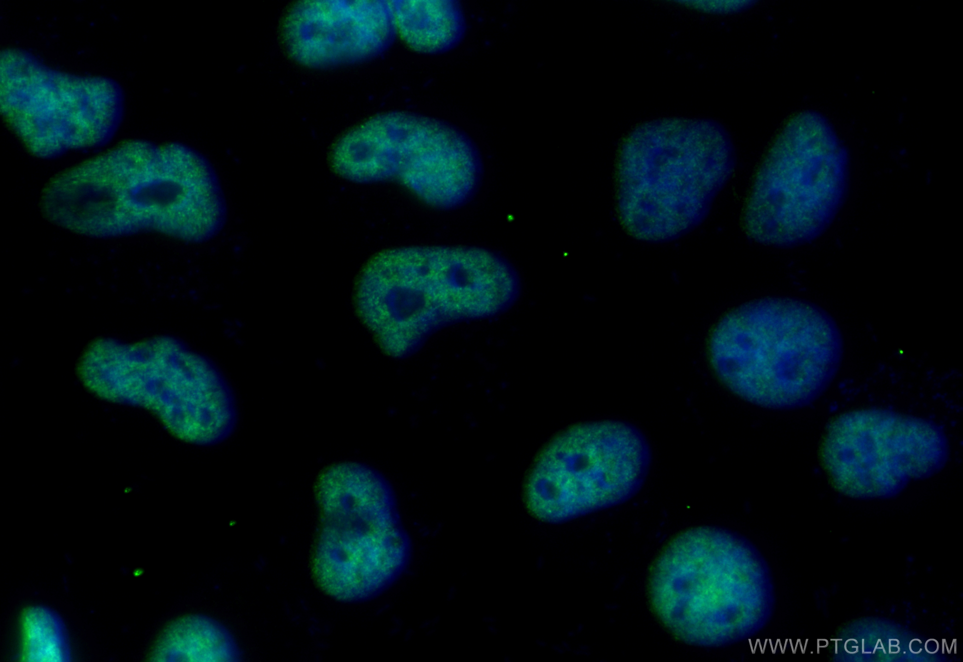 Immunofluorescence (IF) / fluorescent staining of HeLa cells using CoraLite® Plus 488-conjugated Acetyl-Histone H3 (L (CL488-84543)