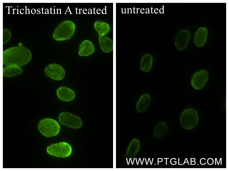 Immunofluorescence (IF) / fluorescent staining of NIH/3T3 cells using Acetyl-Histone H4 (Lys12) Recombinant monoclonal a (83095-1-RR)