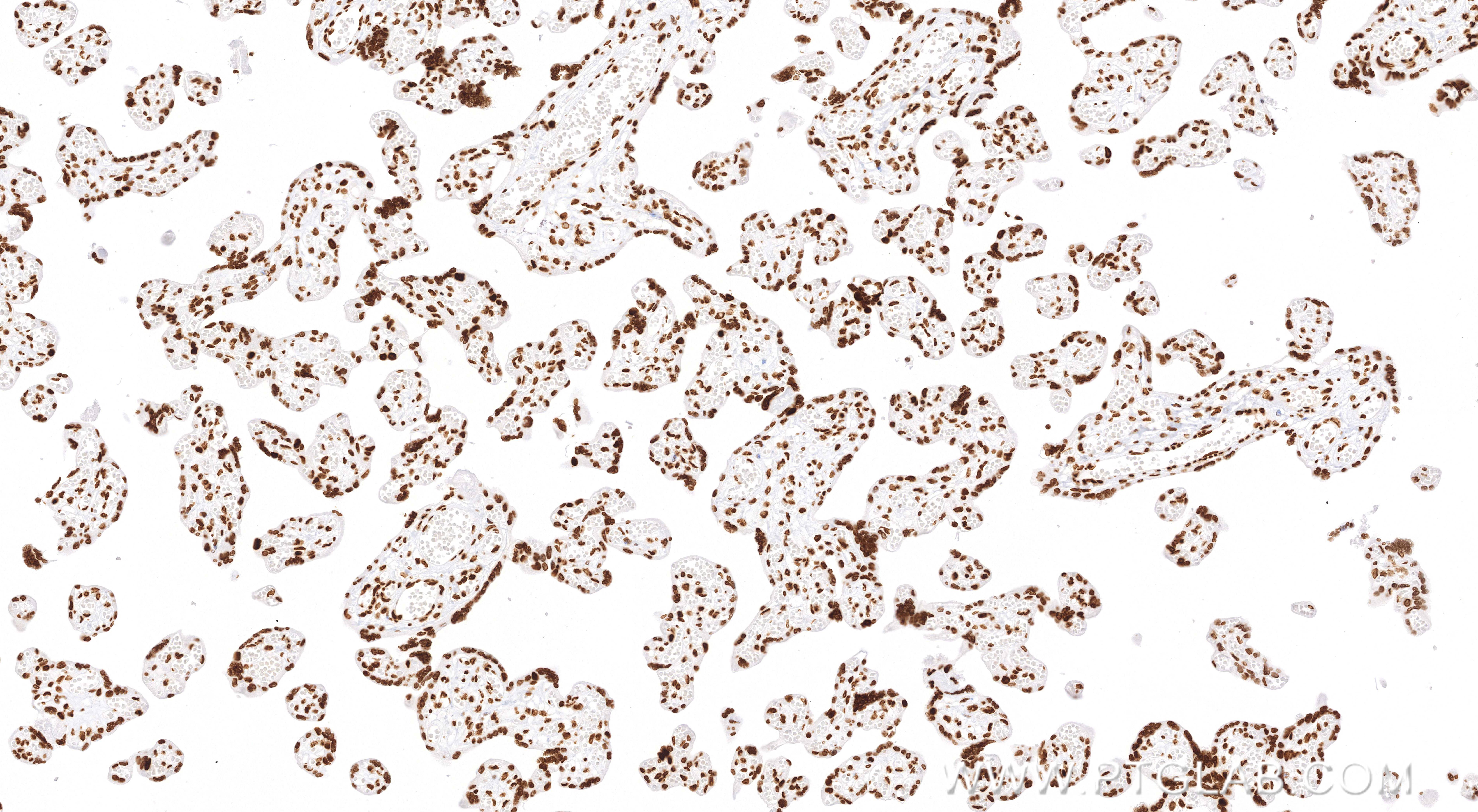 Immunohistochemistry (IHC) staining of human placenta tissue using Acetyl-Histone H4 (Lys12) Recombinant monoclonal a (83095-1-RR)