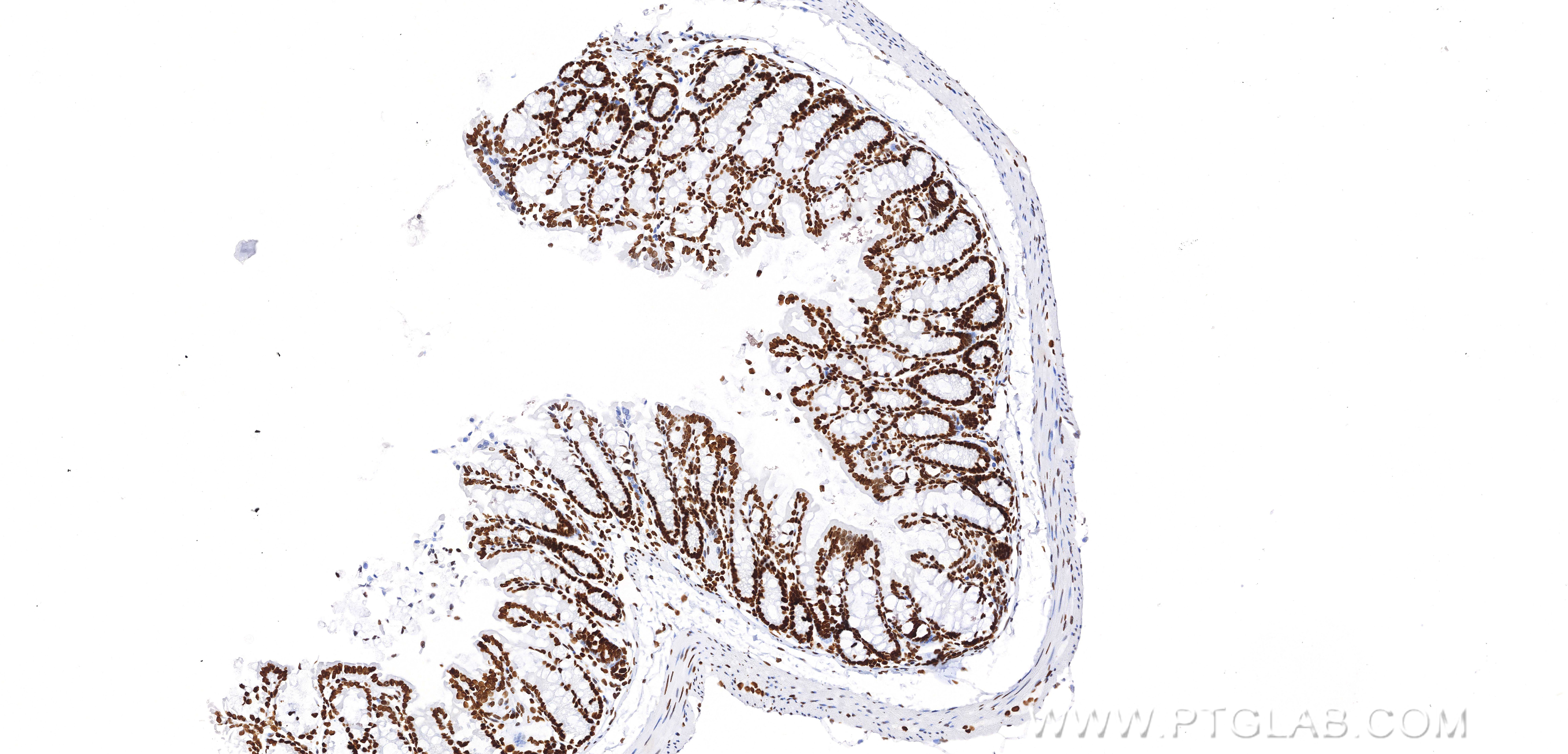 Immunohistochemistry (IHC) staining of mouse colon tissue using Acetyl-Histone H4 (Lys12) Recombinant monoclonal a (83095-1-RR)