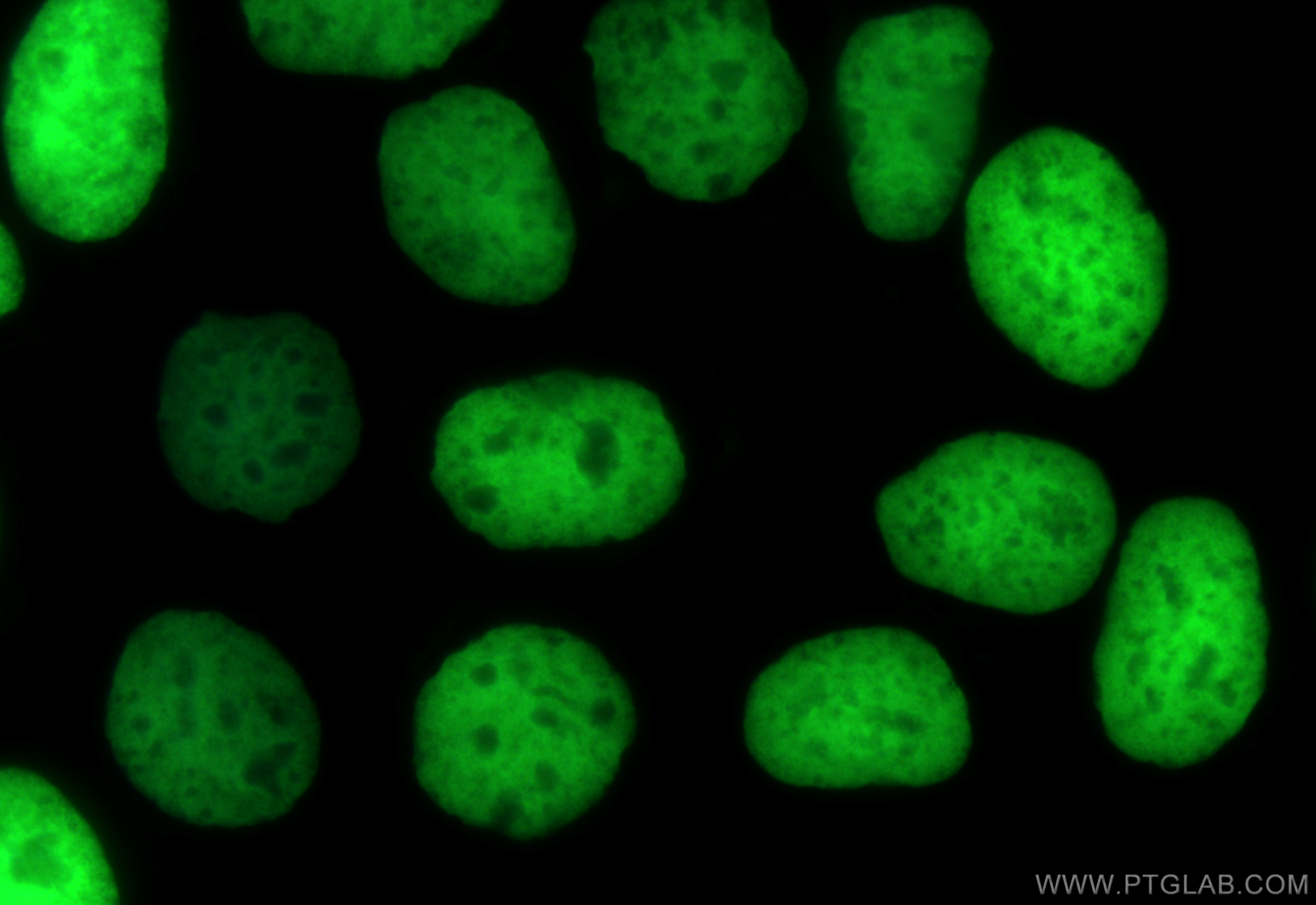 Immunofluorescence (IF) / fluorescent staining of Caco-2 cells using CoraLite® Plus 488-conjugated Acetyl-Histone H4 (L (CL488-83095)