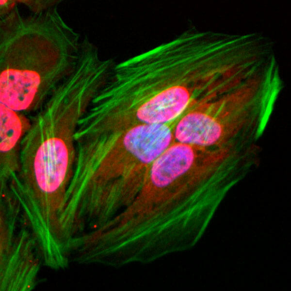 Immunofluorescence stain of Acetyl-Lysine antibody (rAb). HeLa cells were stained using Acetyl-Lysine antibody (RM101) at 2 ug/ml (red). Actin filaments was labeled with fluorescein phalloidin (green), and nucleus stained with DAPI (blue).