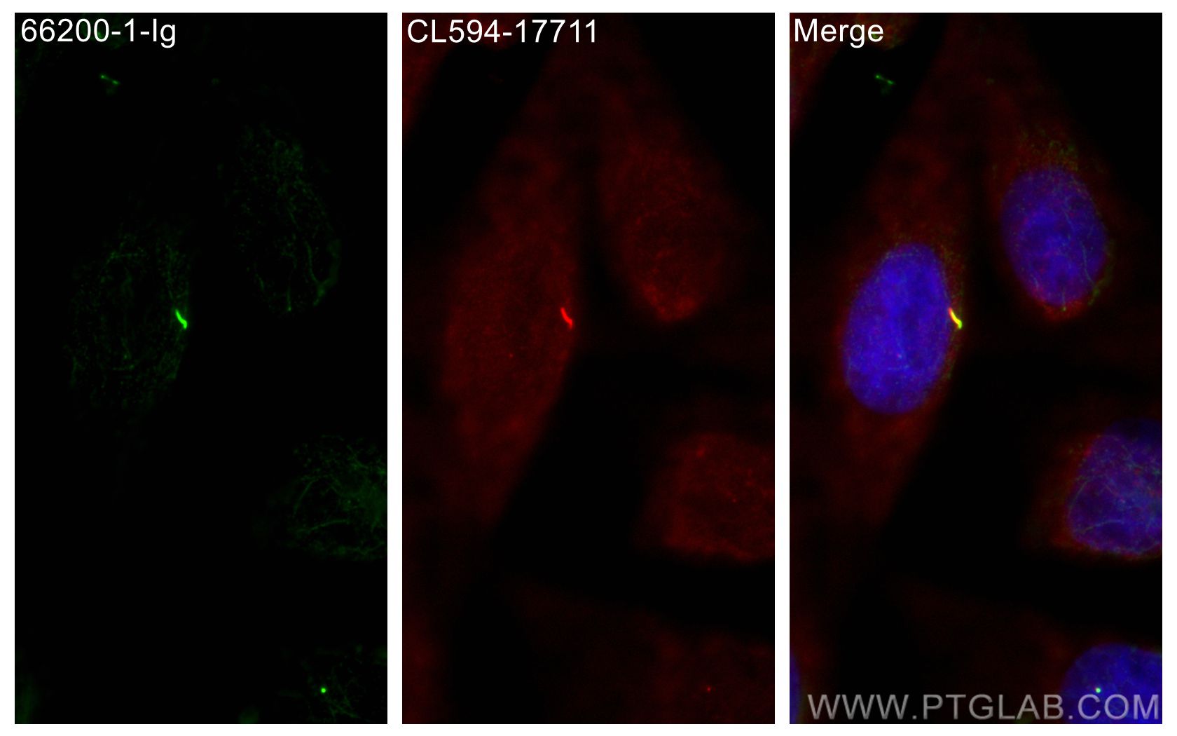 Immunofluorescence (IF) / fluorescent staining of MDCK cells using Acetyl-Tubulin (Lys40) Monoclonal antibody (66200-1-Ig)