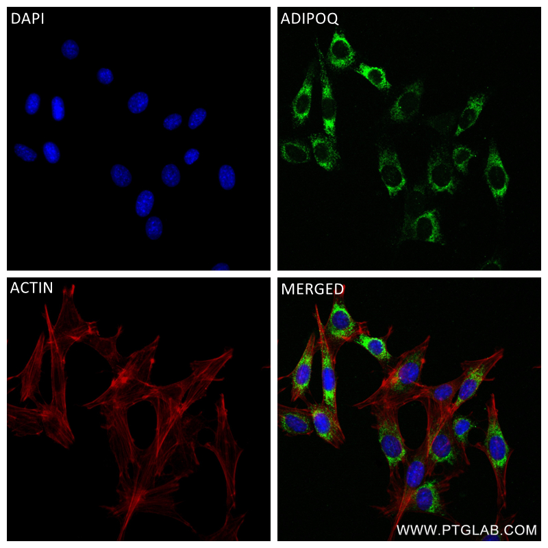 Immunofluorescence (IF) / fluorescent staining of 3T3-L1 cells using Adiponectin Recombinant antibody (83961-1-RR)