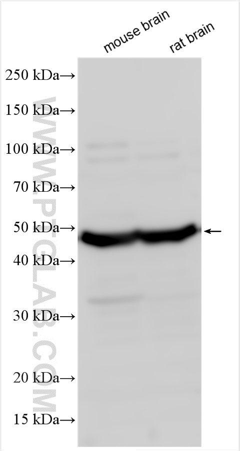 Western Blot (WB) analysis of various lysates using Adiponectin receptor 1 Polyclonal antibody (22425-1-AP)