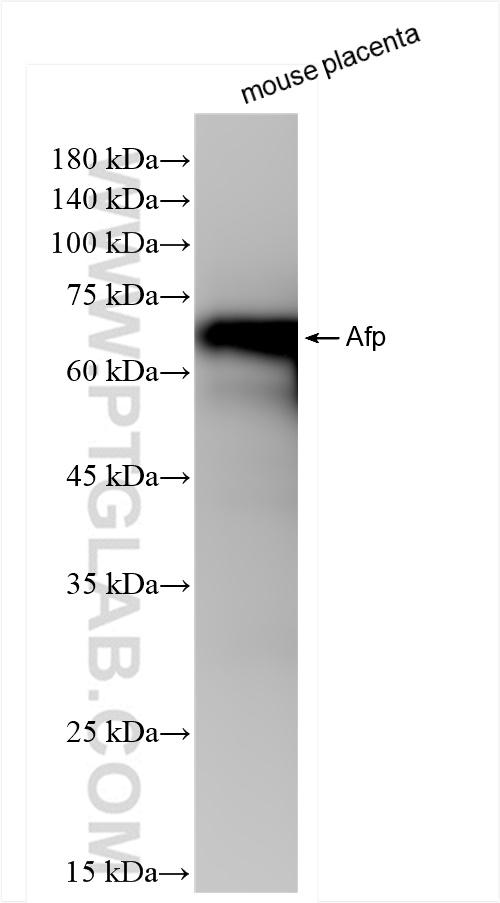 Western Blot (WB) analysis of mouse placenta tissue using Afp Recombinant antibody (83367-2-RR)