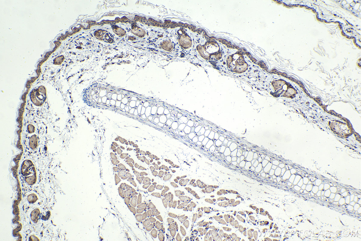 Immunohistochemistry (IHC) staining of mouse skin tissue using Ajuba Polyclonal antibody (28686-1-AP)