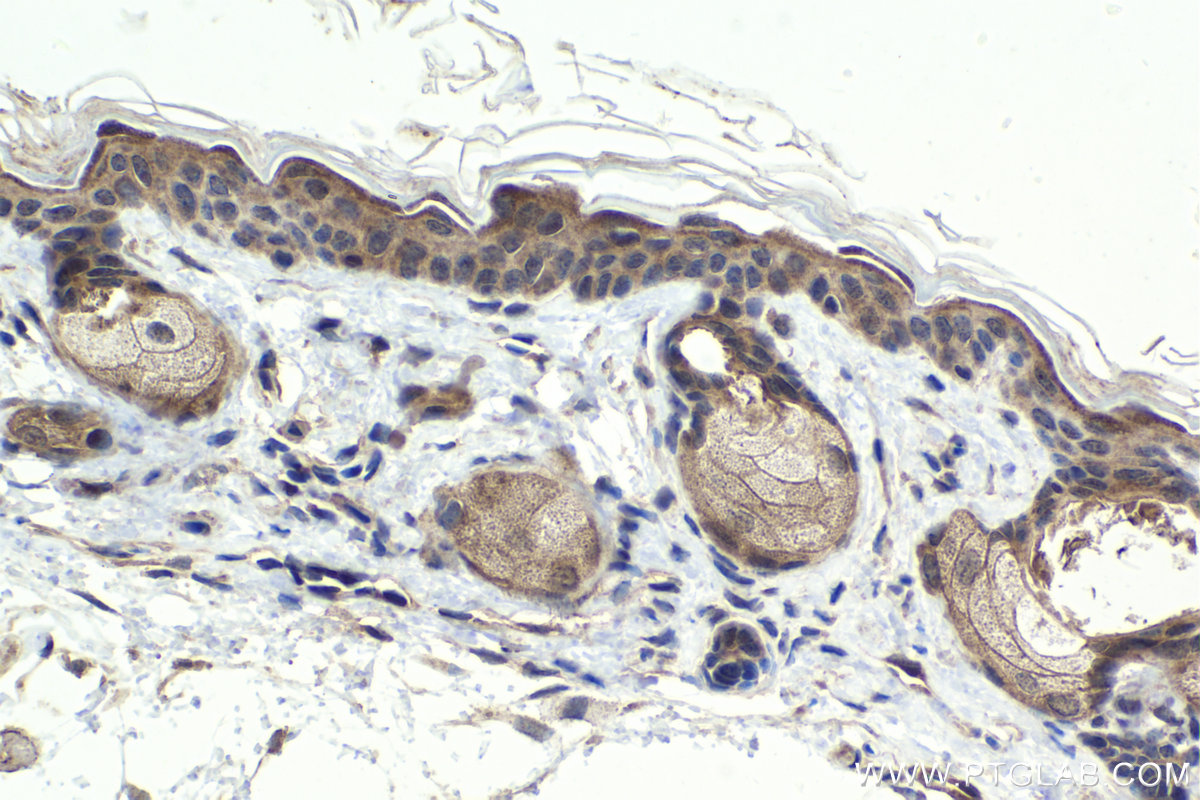 Immunohistochemistry (IHC) staining of mouse skin tissue using Ajuba Polyclonal antibody (28686-1-AP)