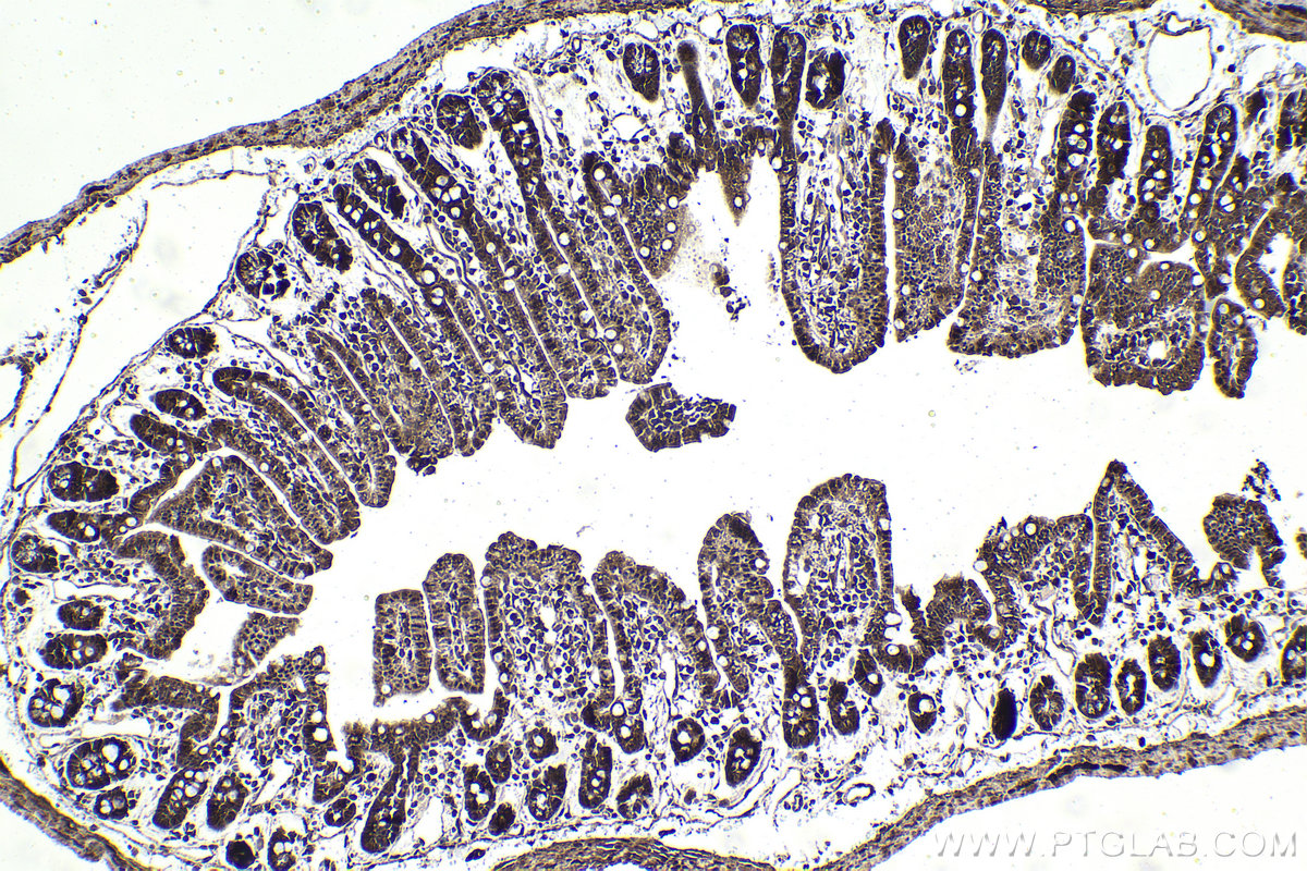 Immunohistochemistry (IHC) staining of mouse small intestine tissue using Ajuba Polyclonal antibody (28686-1-AP)