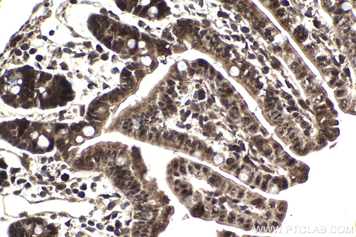 Immunohistochemistry (IHC) staining of mouse small intestine tissue using Ajuba Polyclonal antibody (28686-1-AP)