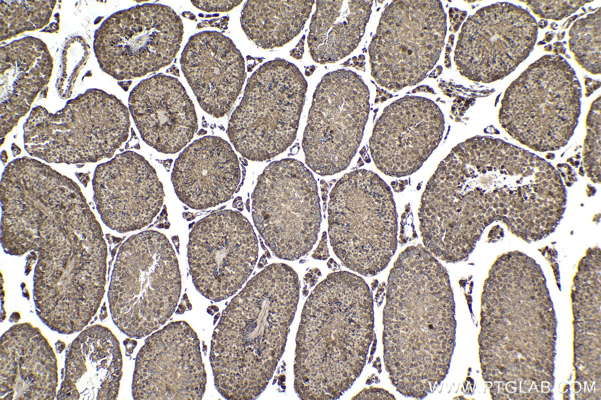 Immunohistochemistry (IHC) staining of mouse testis tissue using Ajuba Polyclonal antibody (28686-1-AP)