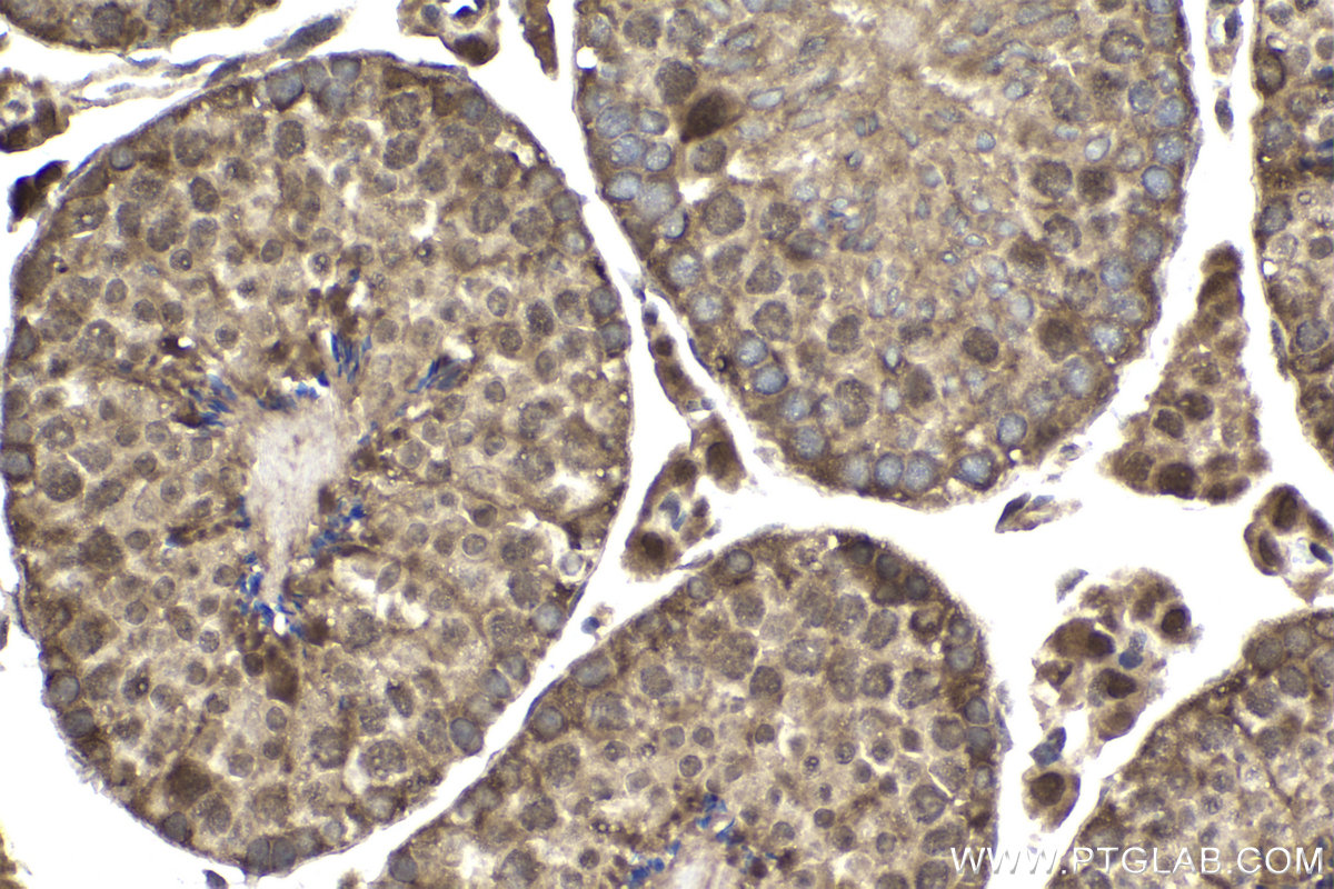 Immunohistochemistry (IHC) staining of mouse testis tissue using Ajuba Polyclonal antibody (28686-1-AP)