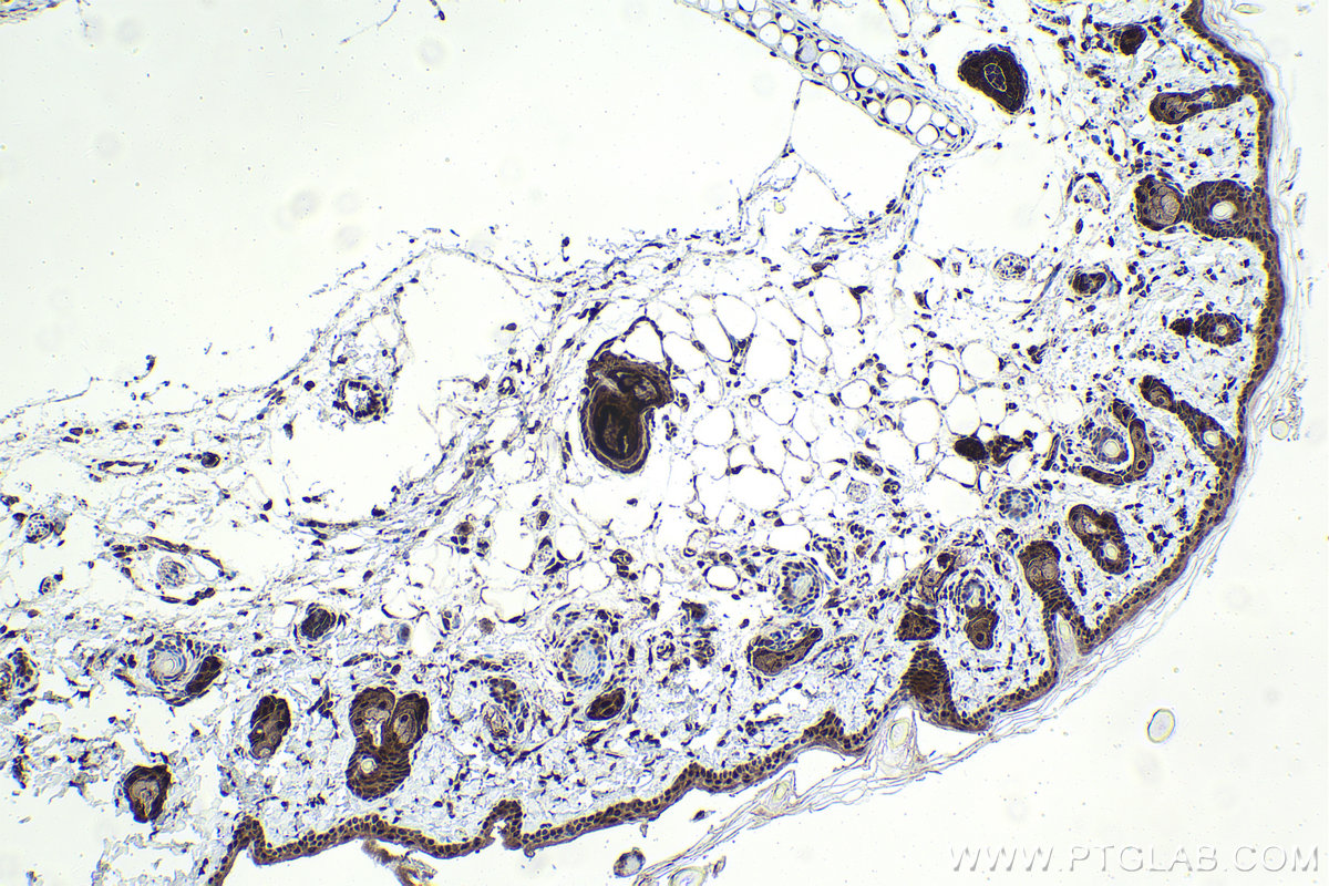 Immunohistochemistry (IHC) staining of rat skin tissue using Ajuba Polyclonal antibody (28686-1-AP)