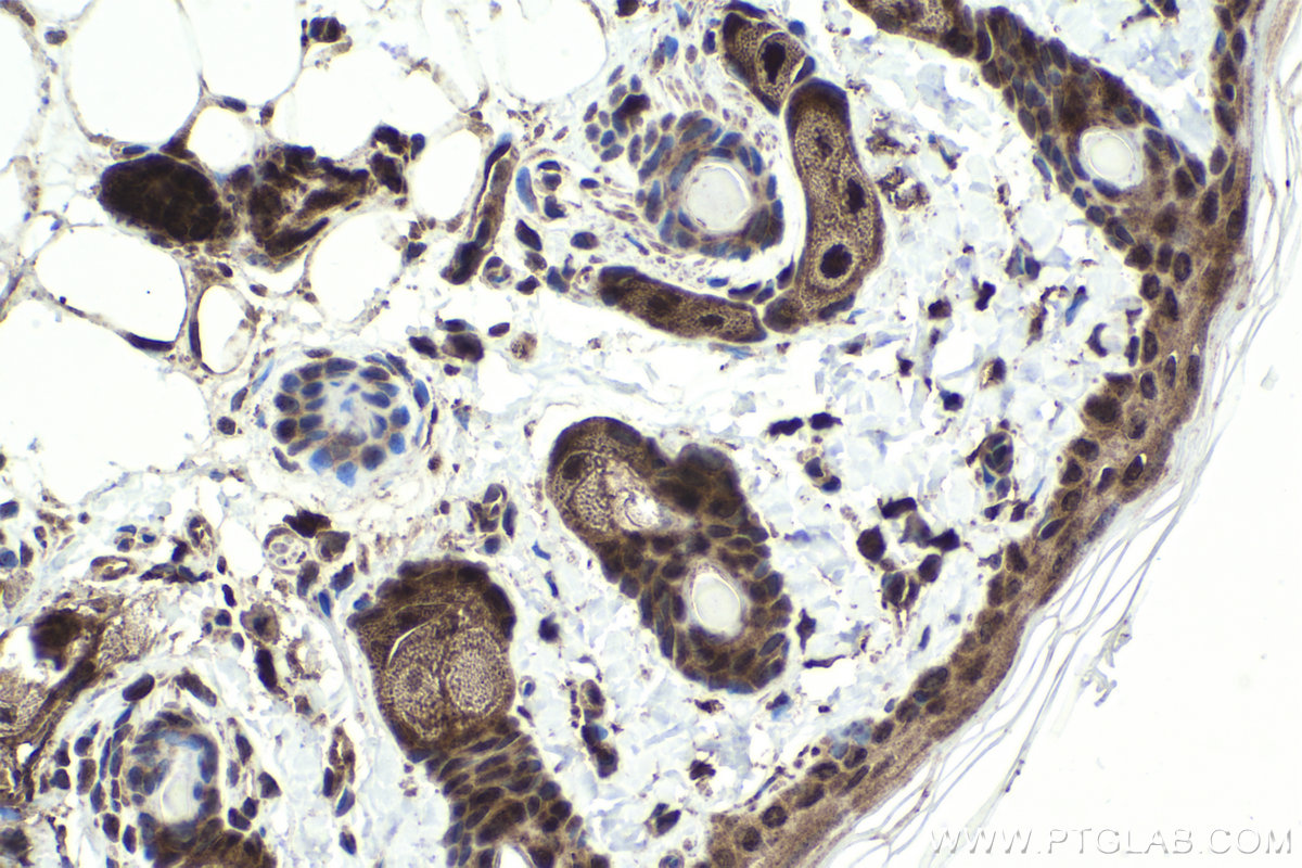 Immunohistochemistry (IHC) staining of rat skin tissue using Ajuba Polyclonal antibody (28686-1-AP)