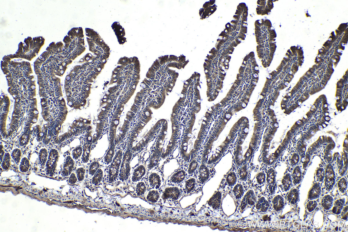 Immunohistochemistry (IHC) staining of rat small intestine tissue using Ajuba Polyclonal antibody (28686-1-AP)