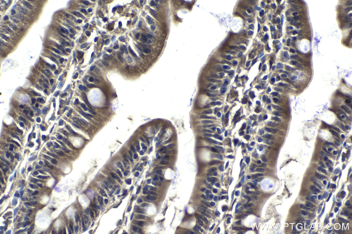 Immunohistochemistry (IHC) staining of rat small intestine tissue using Ajuba Polyclonal antibody (28686-1-AP)