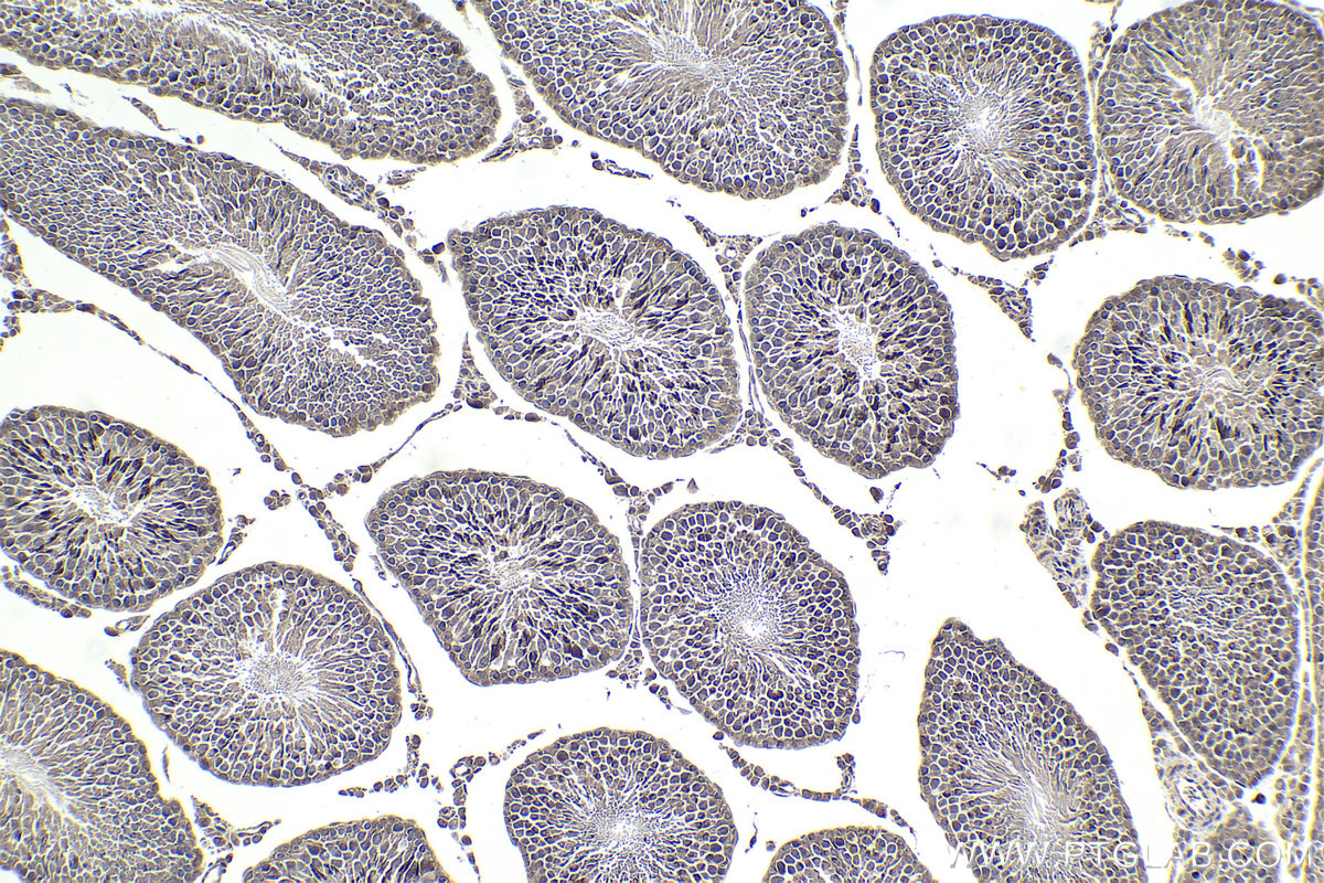 Immunohistochemistry (IHC) staining of rat testis tissue using Ajuba Polyclonal antibody (28686-1-AP)