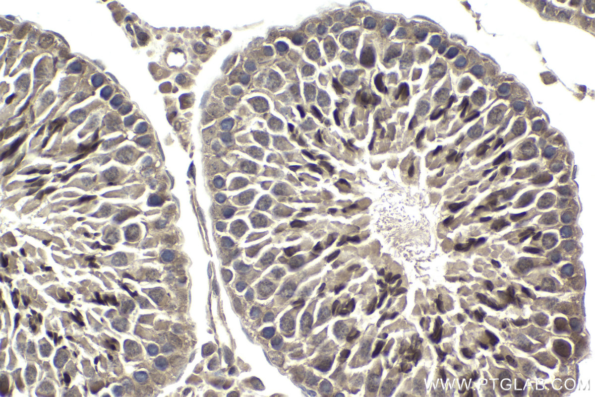 Immunohistochemistry (IHC) staining of rat testis tissue using Ajuba Polyclonal antibody (28686-1-AP)