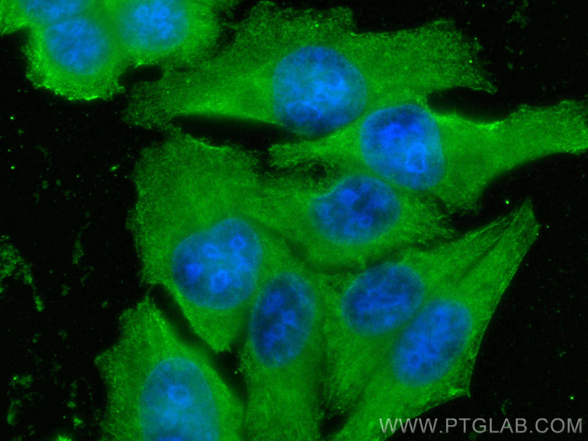 Immunofluorescence (IF) / fluorescent staining of HepG2 cells using AlaRS Monoclonal antibody (67909-1-Ig)