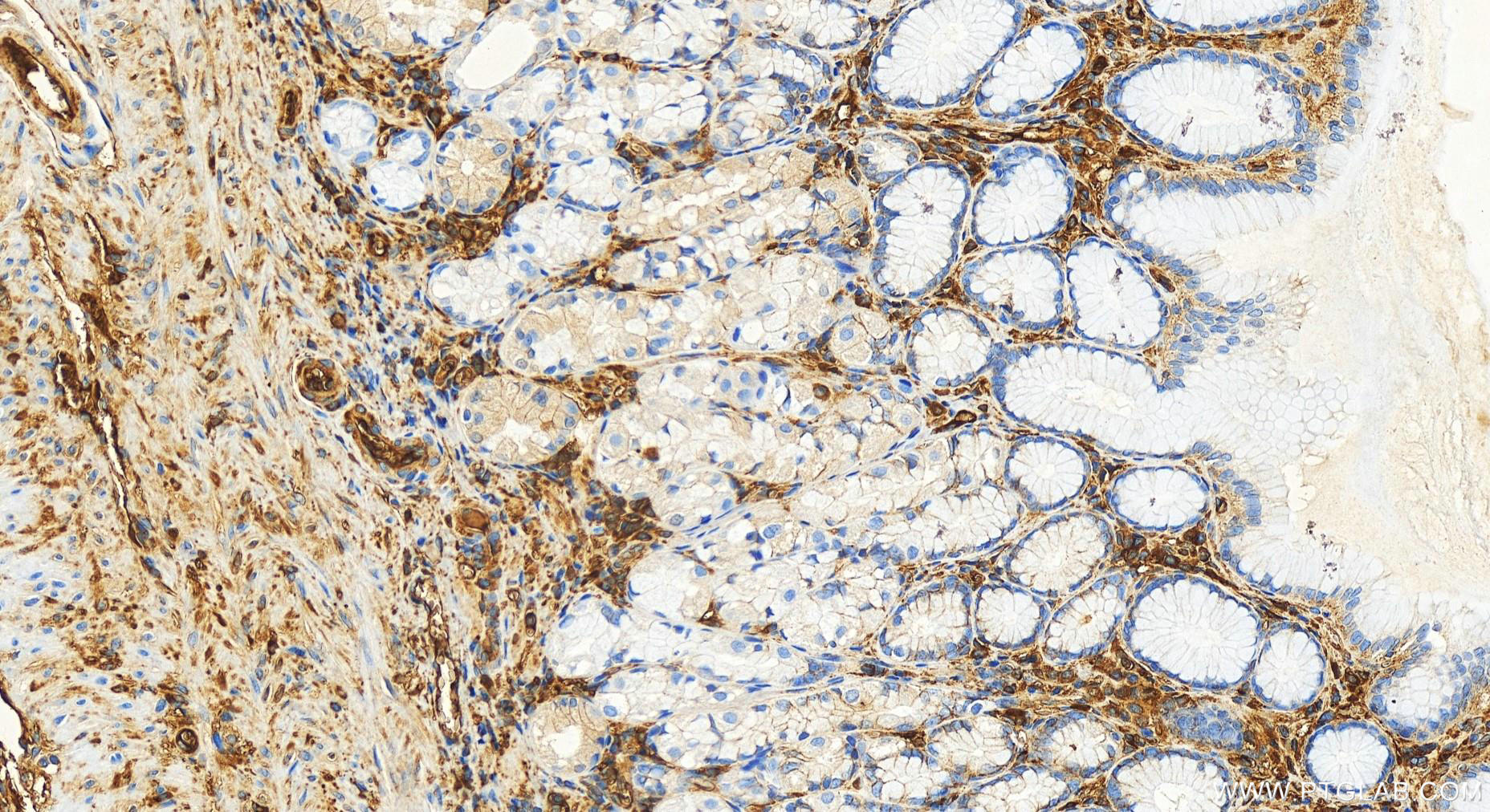 Immunohistochemistry (IHC) staining of human stomach tissue using Albumin Recombinant antibody (82783-6-RR)