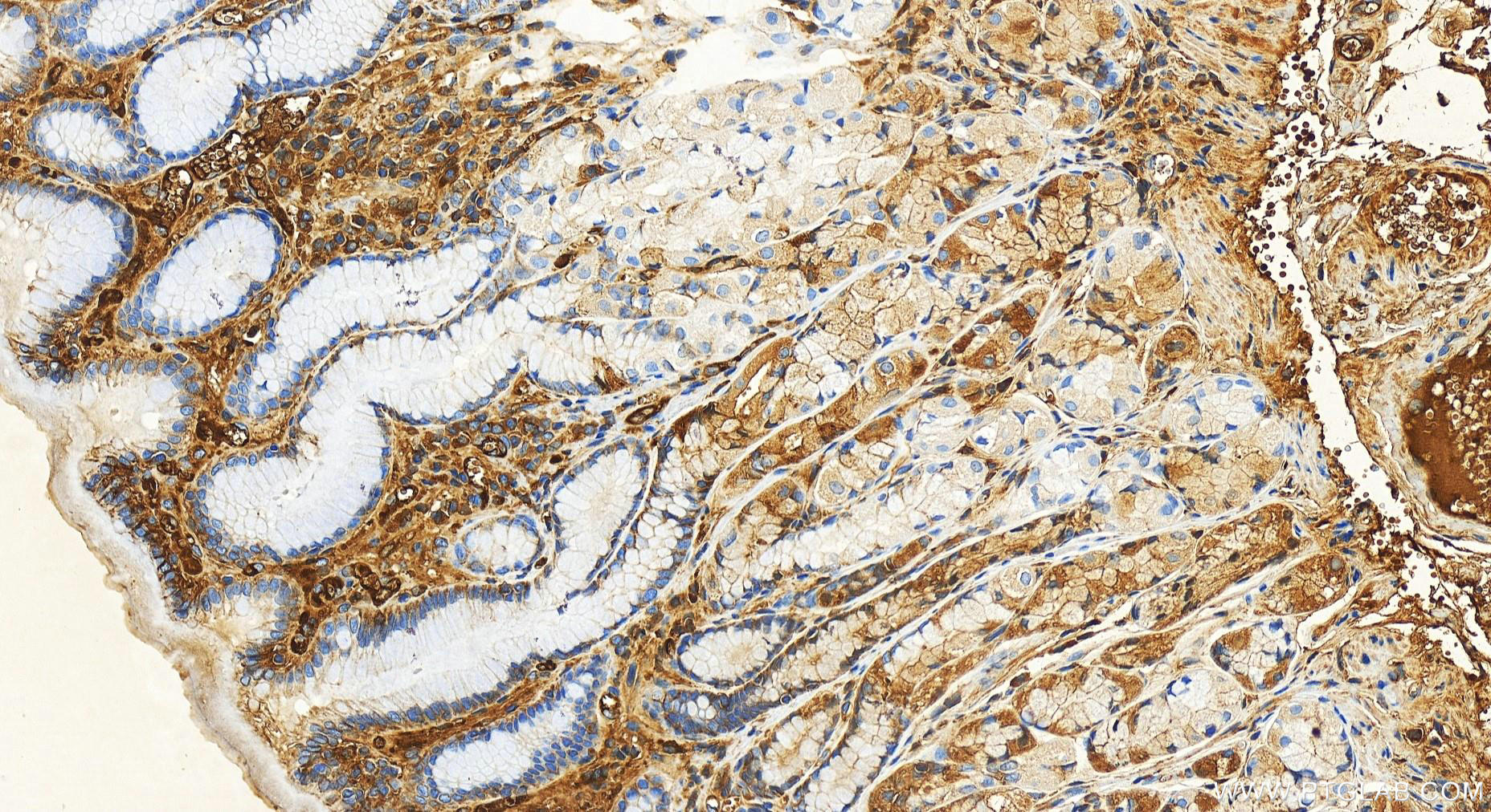 Immunohistochemistry (IHC) staining of human stomach tissue using Albumin Recombinant antibody (82783-6-RR)