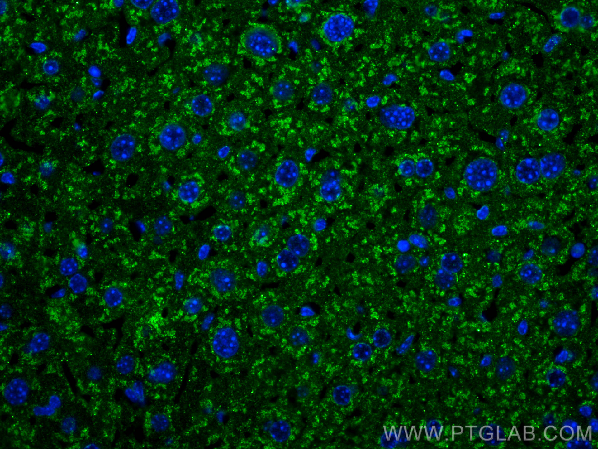 Immunofluorescence (IF) / fluorescent staining of mouse liver tissue using Albumin Recombinant antibody (82783-6-RR)