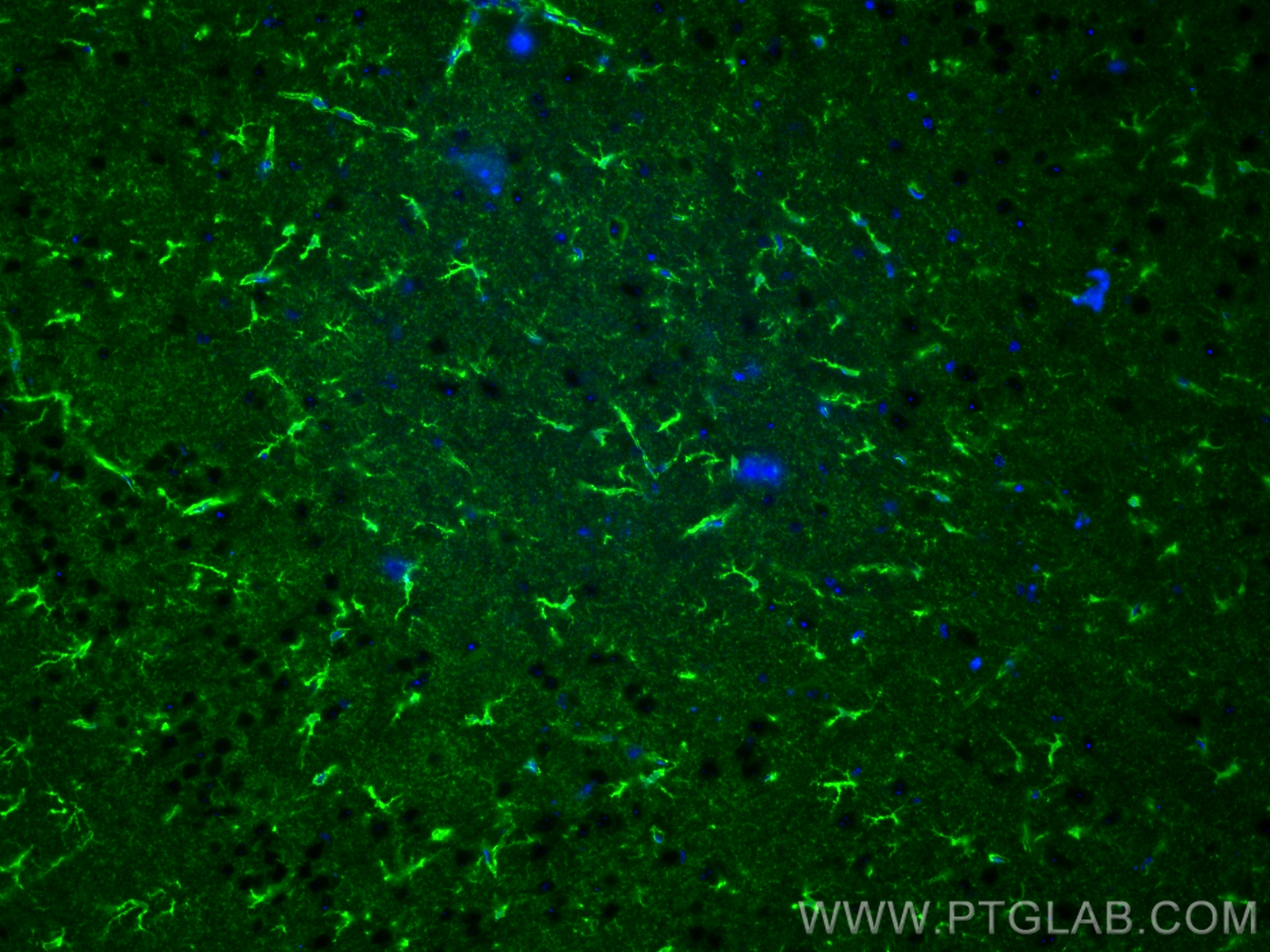 Immunofluorescence (IF) / fluorescent staining of mouse brain tissue using CoraLite® Plus 488-conjugated Aldolase C Polyclona (CL488-14884)