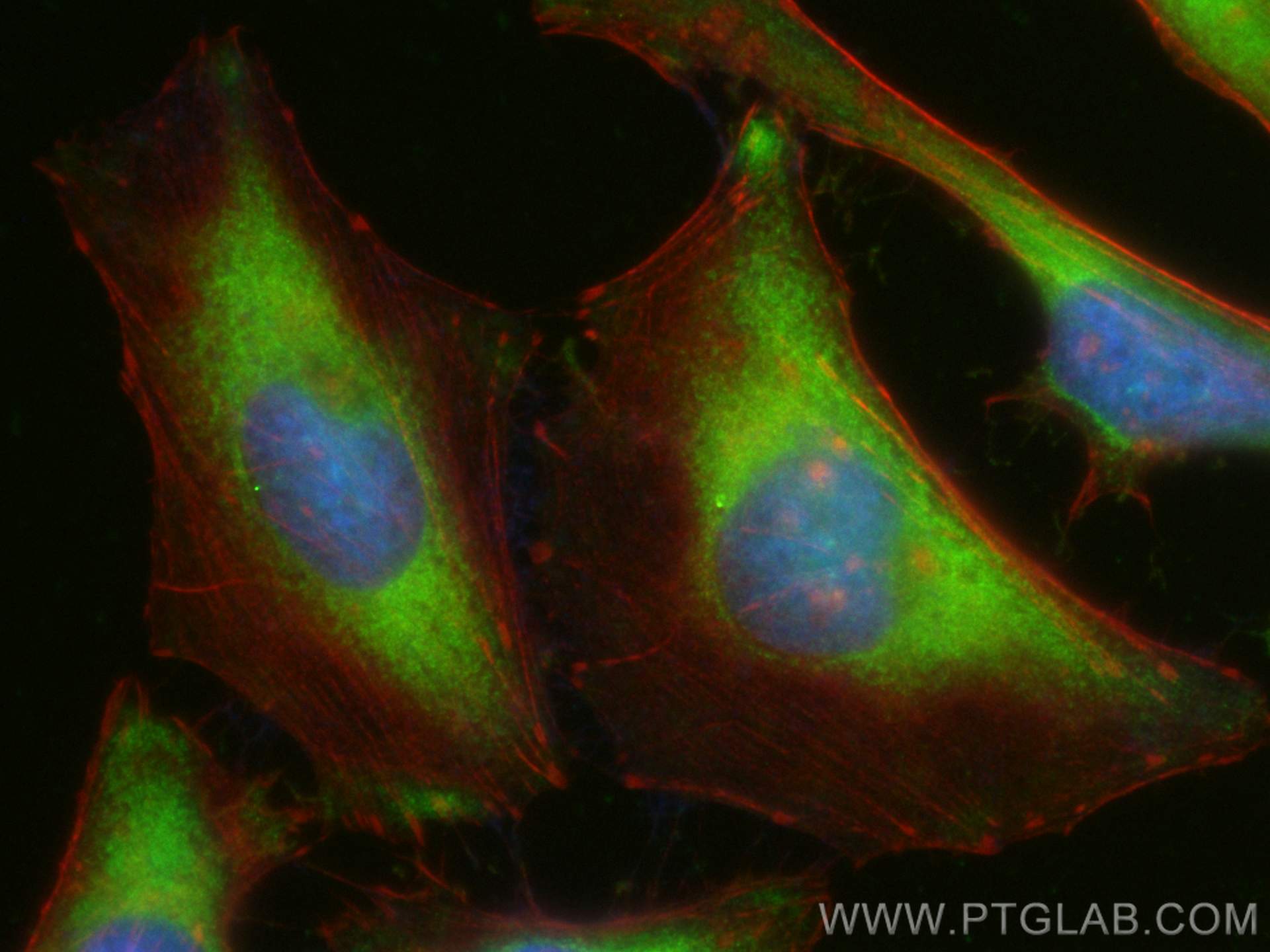 Immunofluorescence (IF) / fluorescent staining of HeLa cells using CoraLite® Plus 488-conjugated Alix Polyclonal anti (CL488-12422)