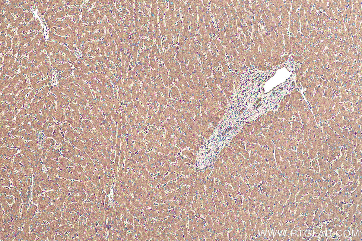 Immunohistochemistry (IHC) staining of human liver tissue using Alpha 1 Antitrypsin Monoclonal antibody (66135-1-Ig)