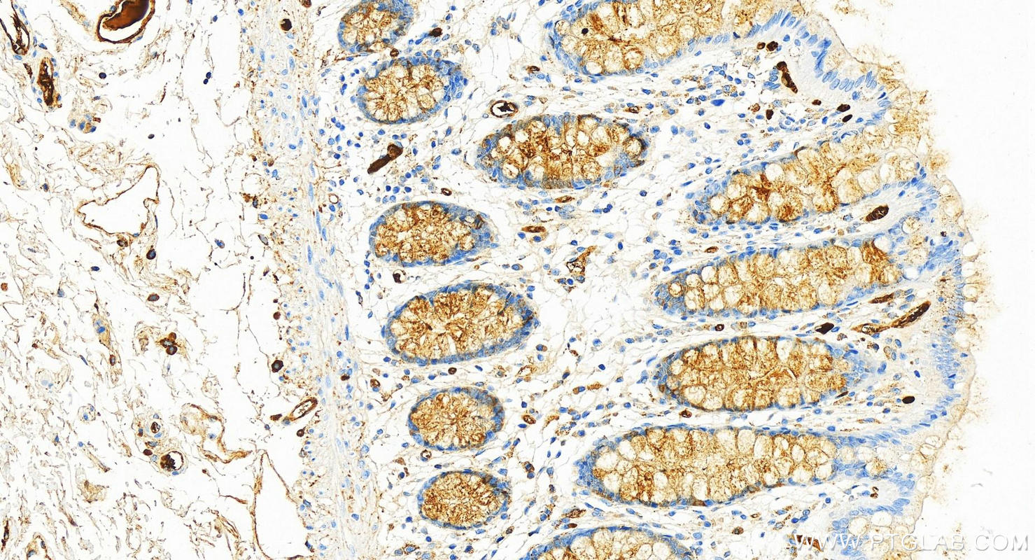 Immunohistochemistry (IHC) staining of human colon tissue using Alpha-1-Antitrypsin Recombinant antibody (82918-1-RR)