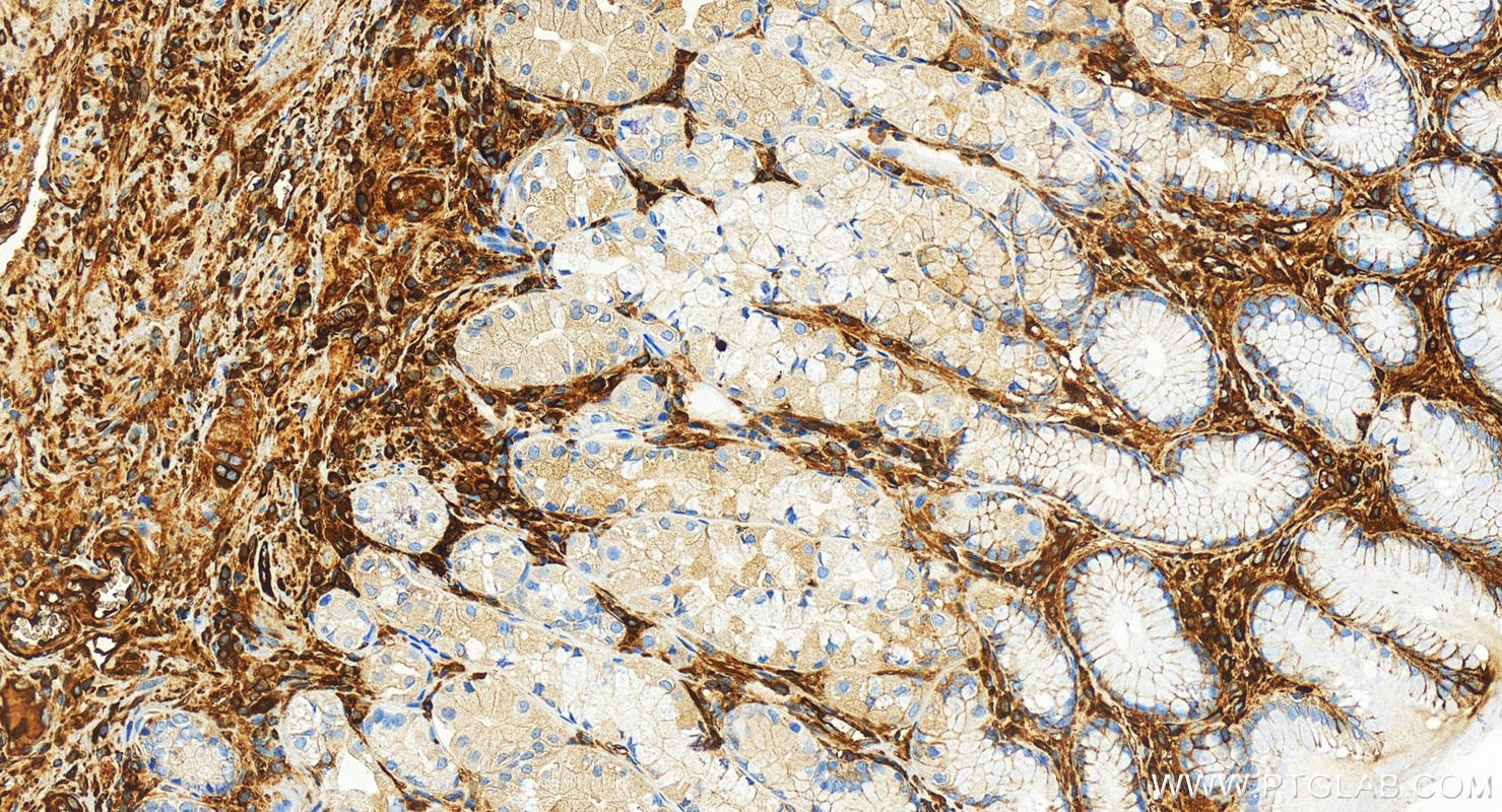 Immunohistochemistry (IHC) staining of human stomach tissue using Alpha-1-Antitrypsin Recombinant antibody (82918-1-RR)